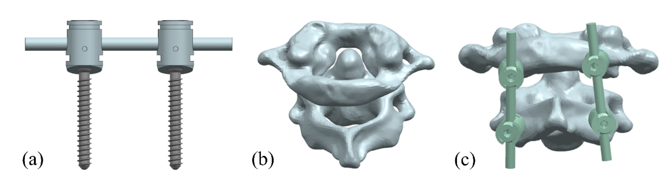 Metals 13 00352 g002