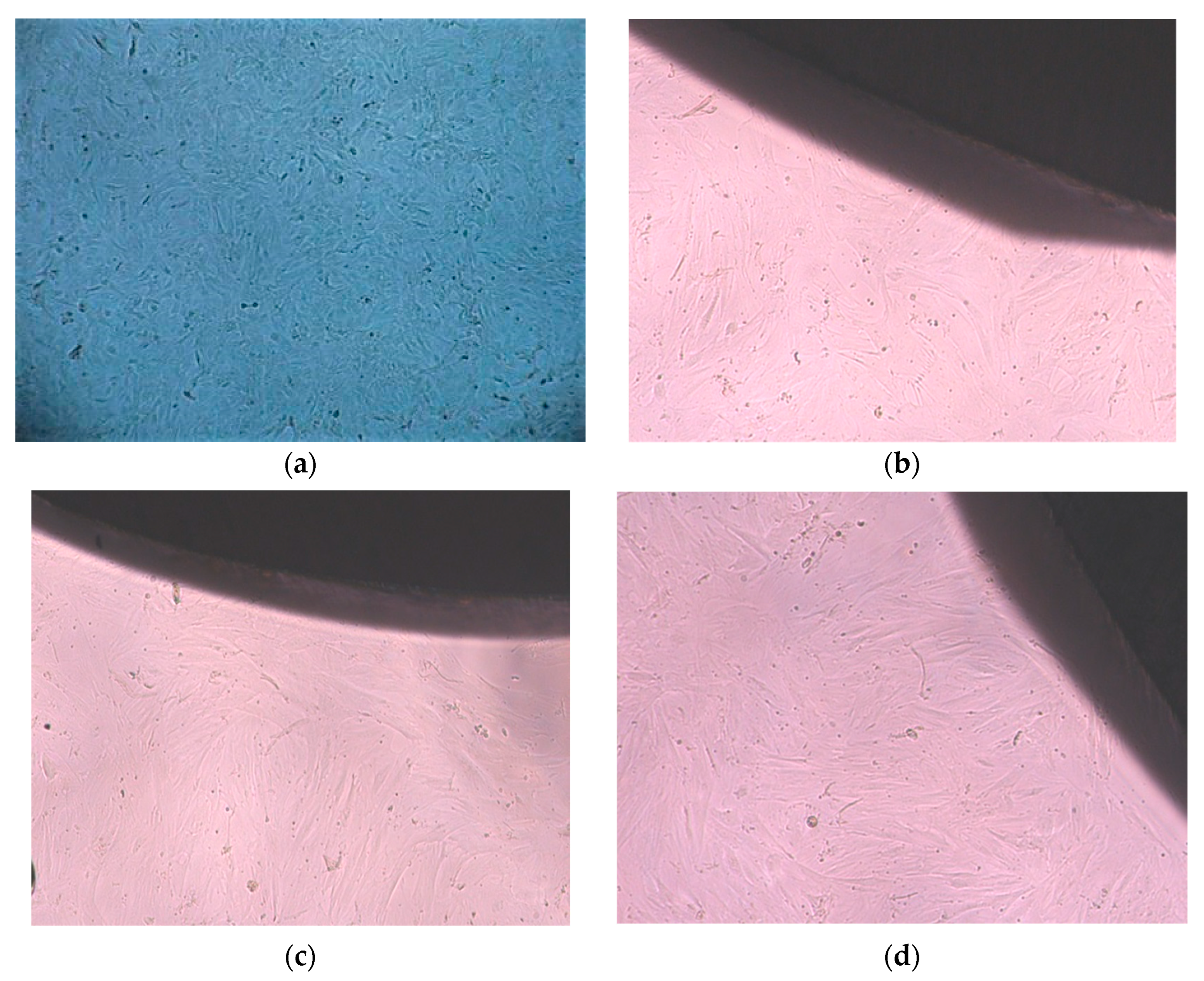 Metals 13 00353 g006