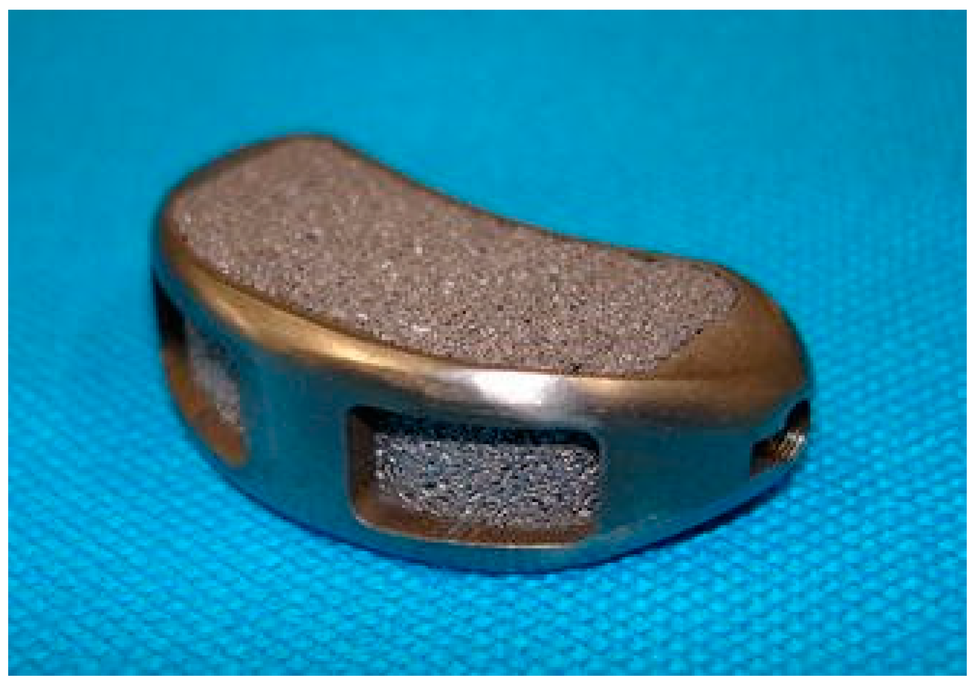 Metals 13 00462 g011 Metals 13 00462 g011