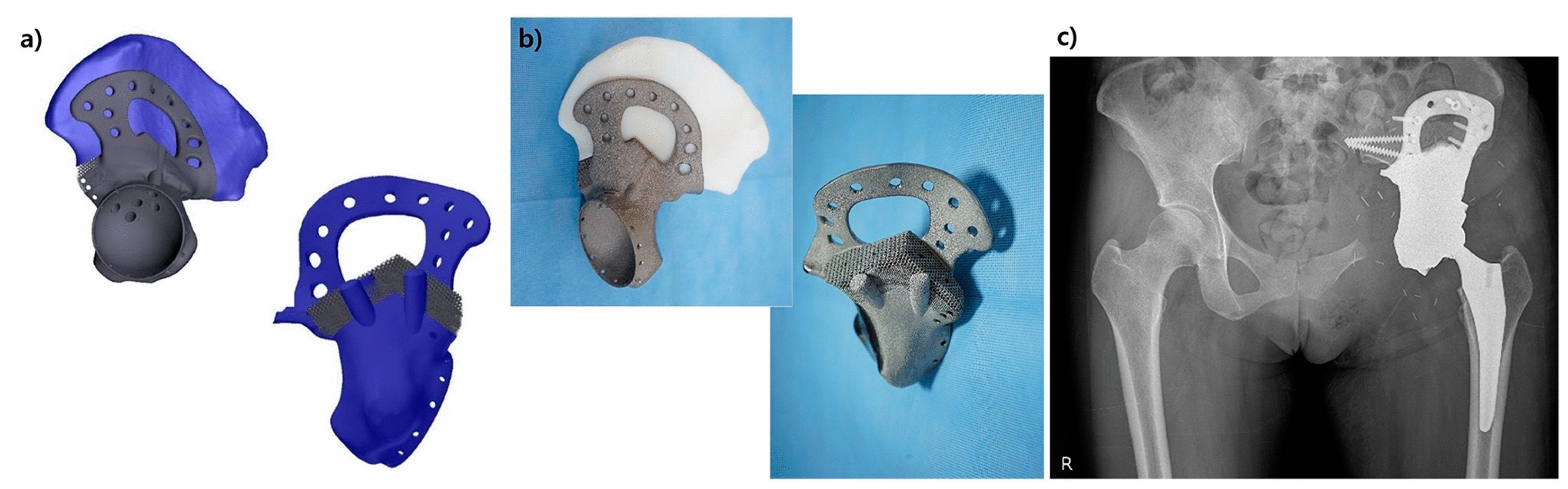 Metals 13 00462 g013 Metals 13 00462 g013