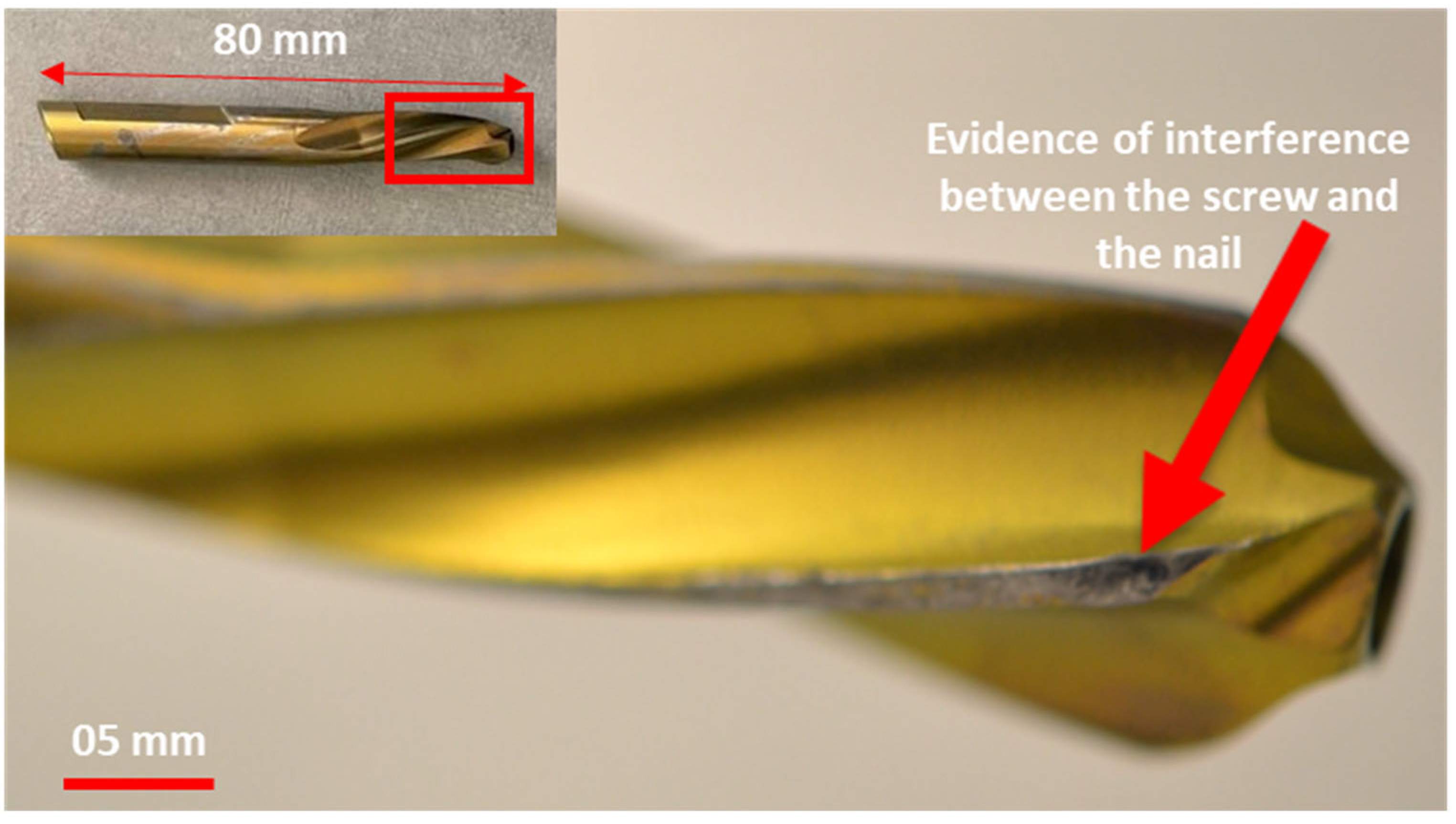 Metals 13 00506 g007 Metals 13 00506 g007