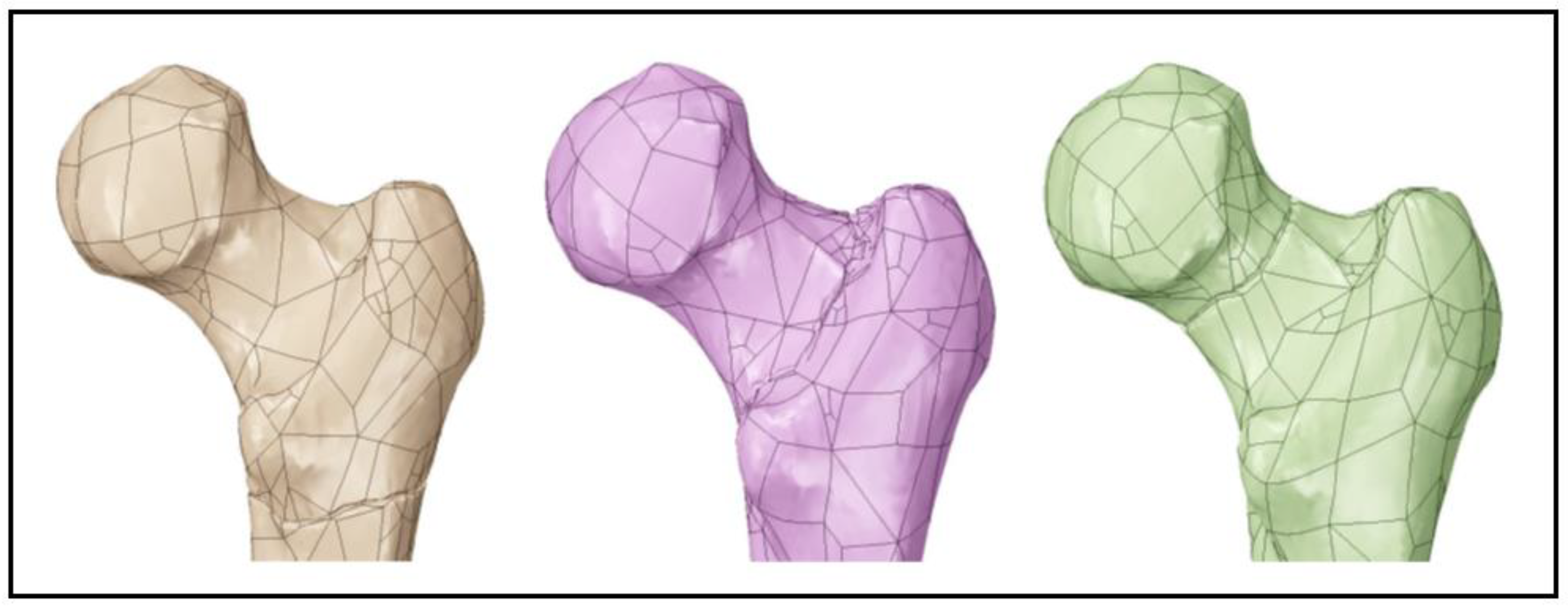 Metals 13 00509 g004