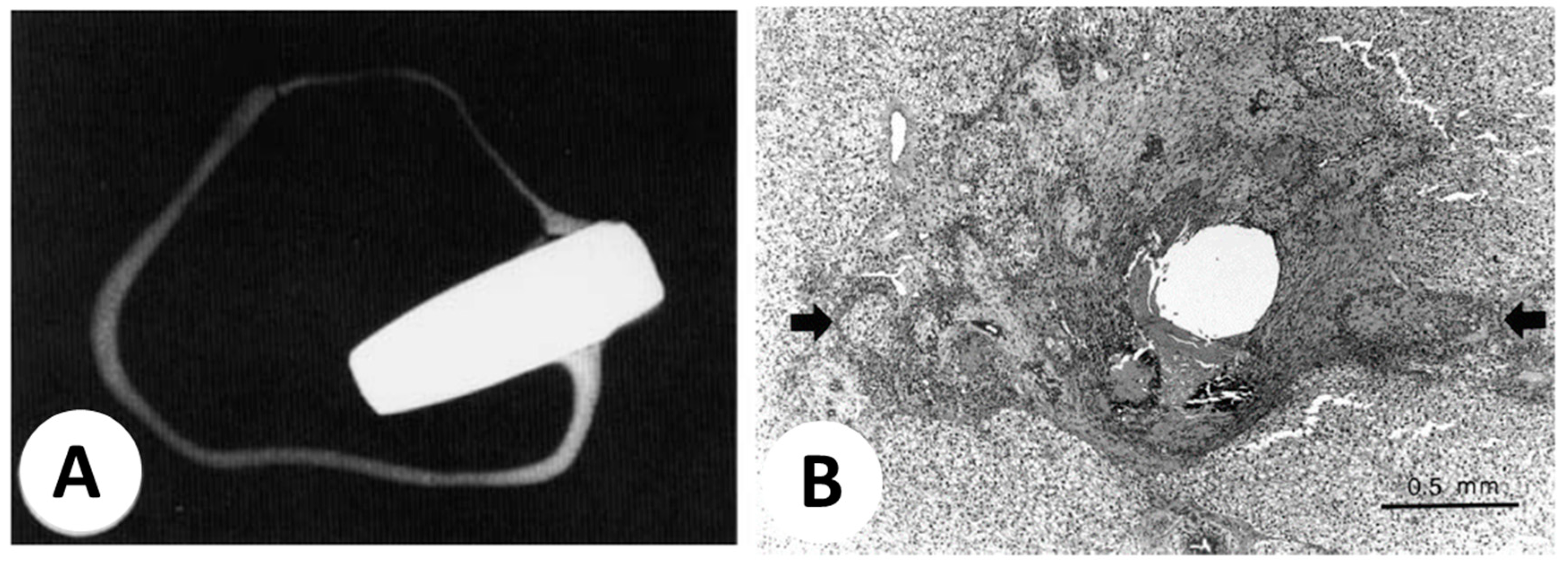 Metals 13 00949 g008