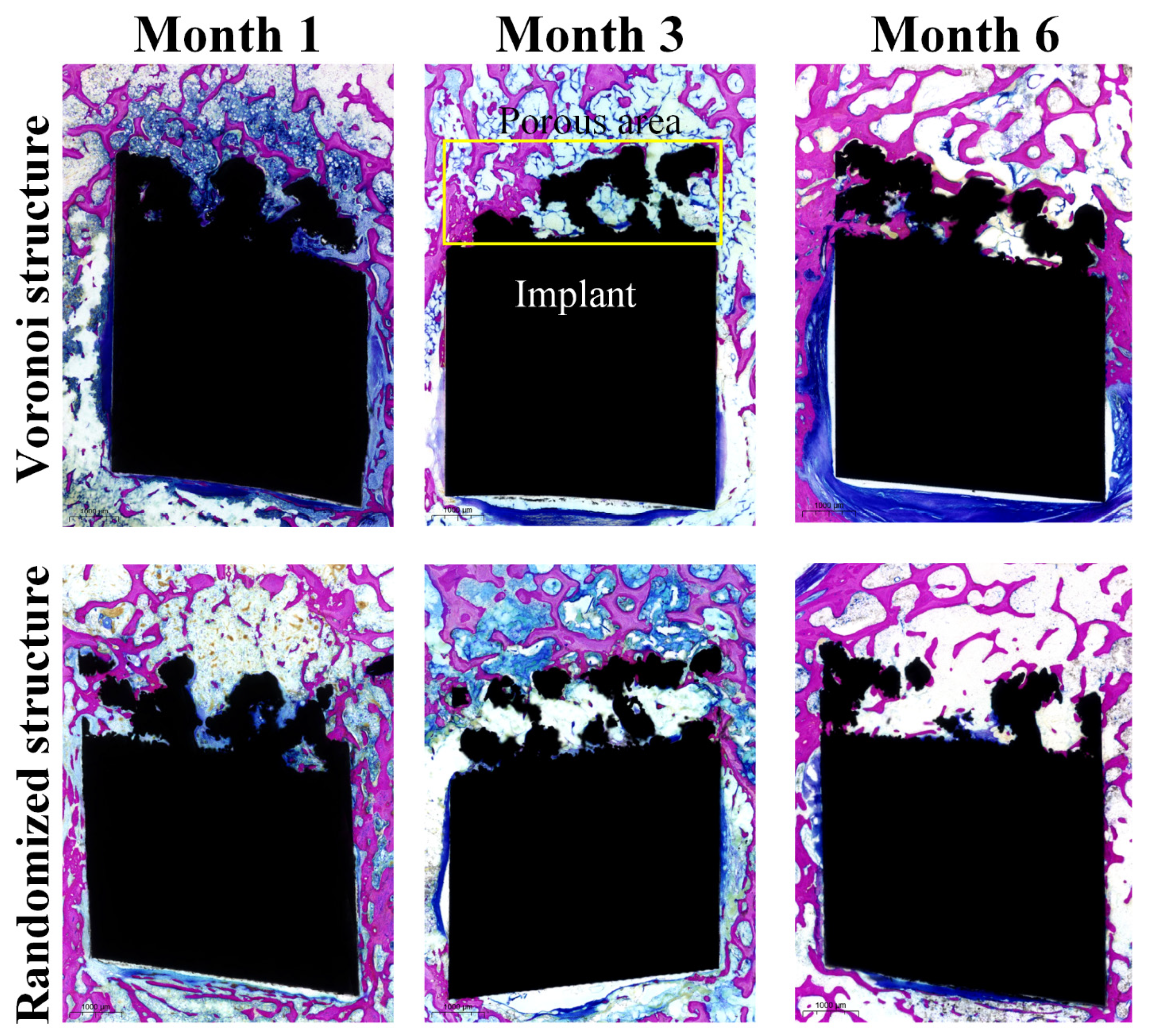 Metals 13 01034 g008