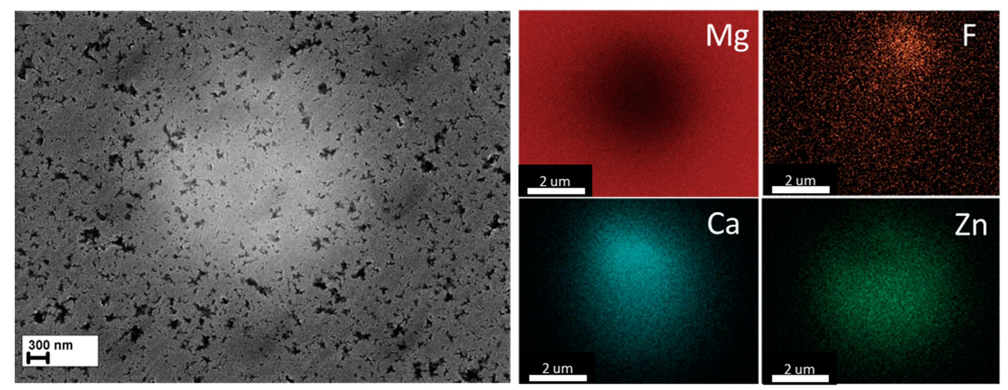 Metals 13 01660 g005