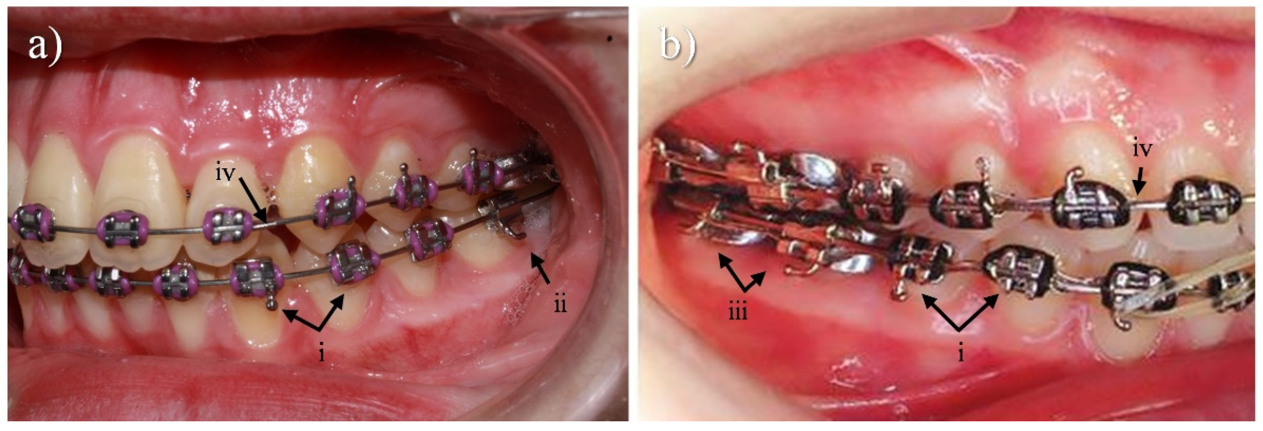 Metals 13 01955 g002