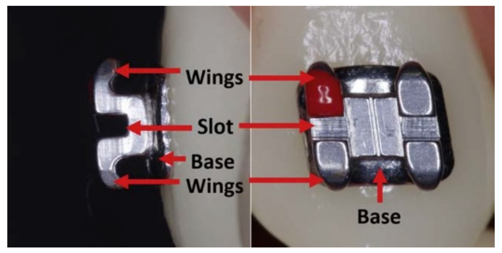 Metals 13 01955 g015