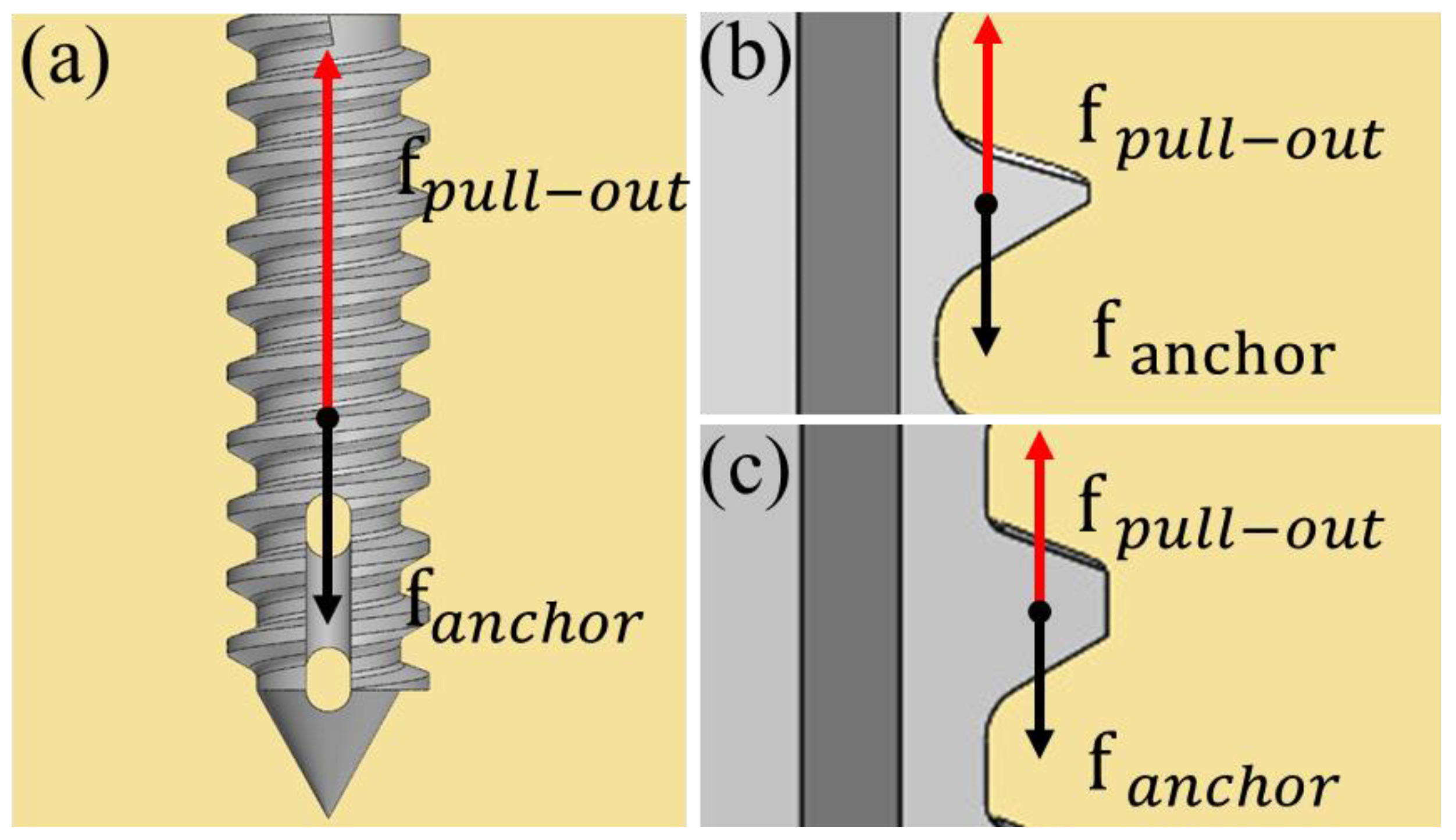 Metals 14 00288 g009