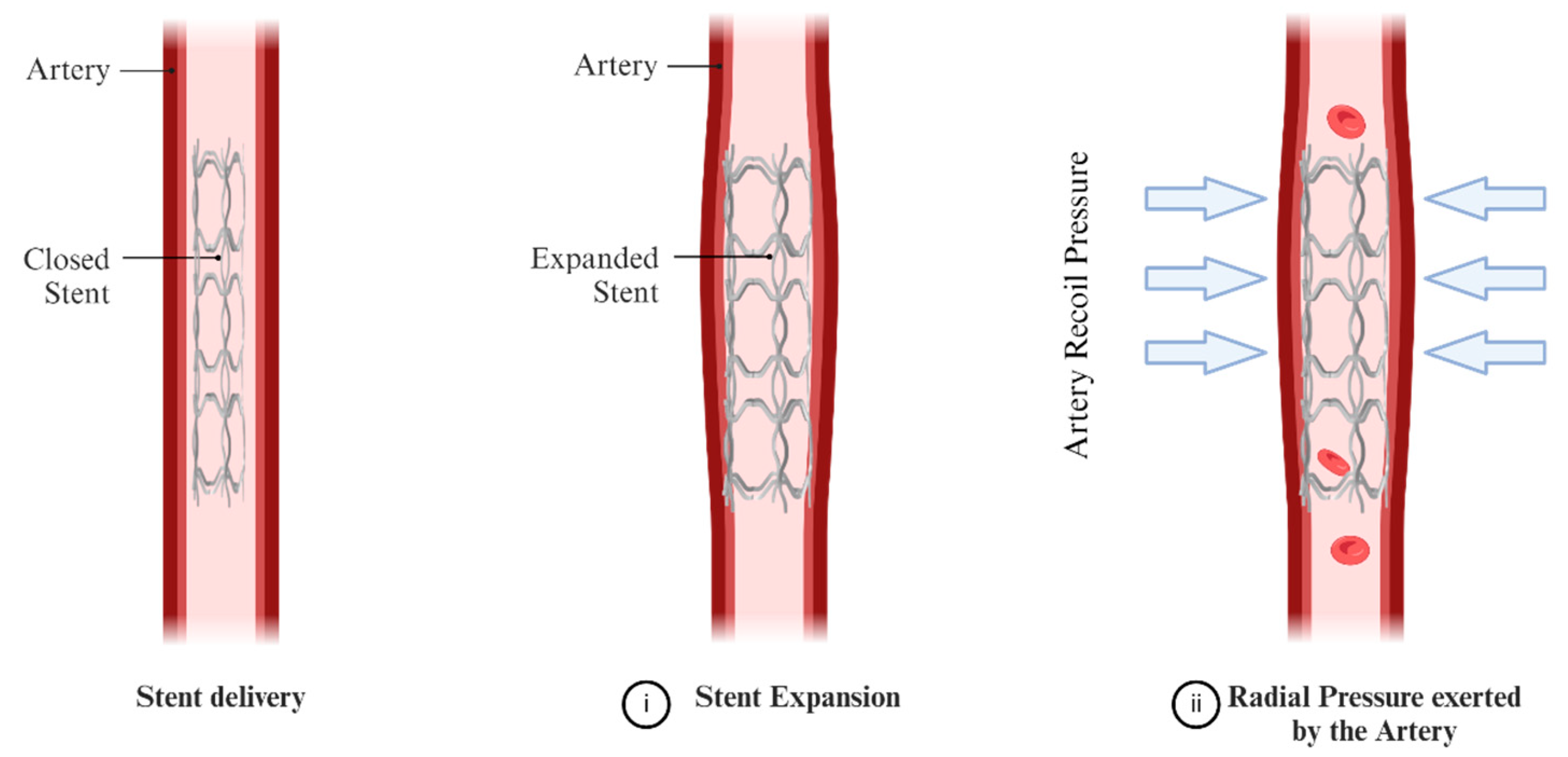 Metals 14 00885 g003