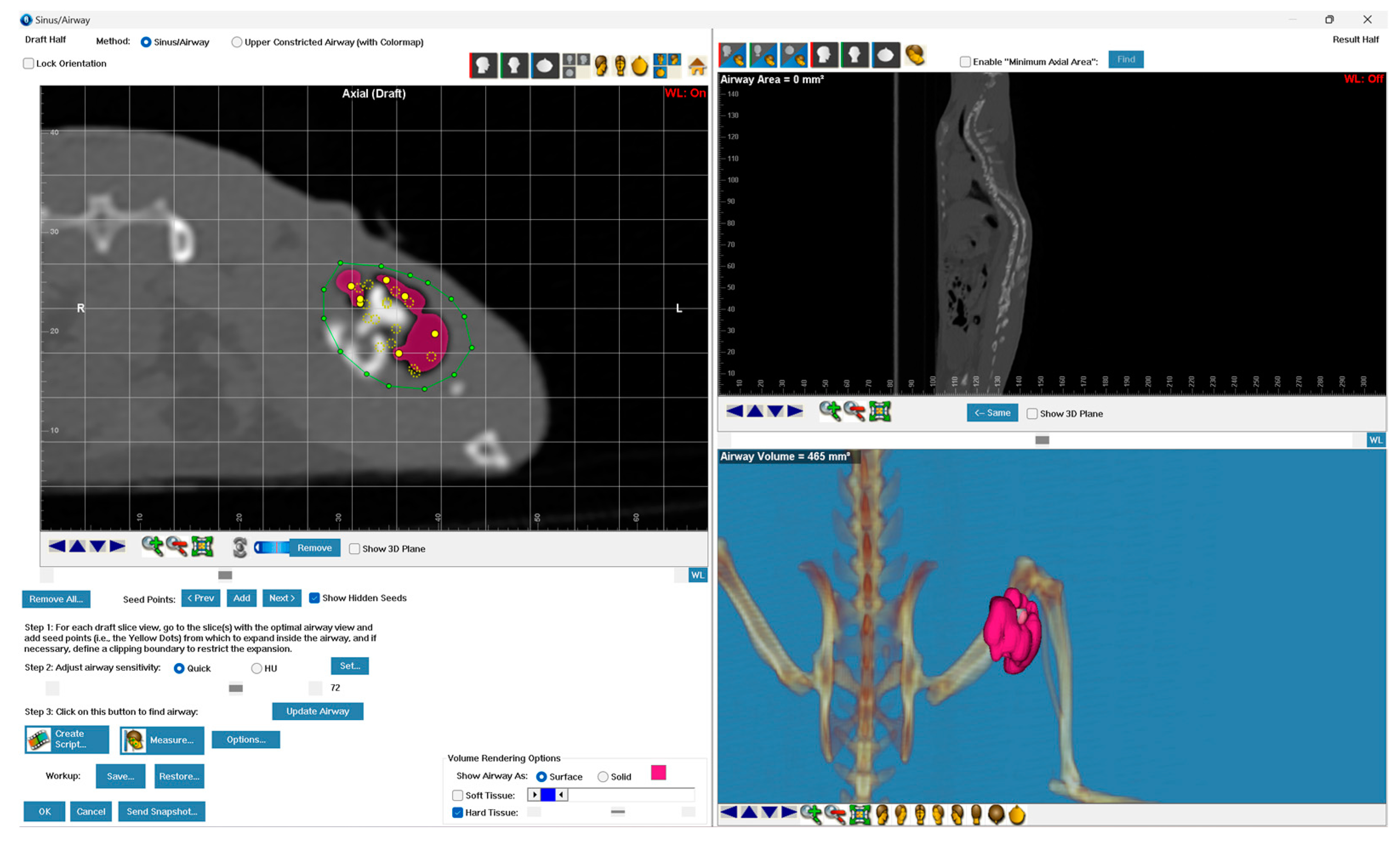 Metals 14 01411 g004