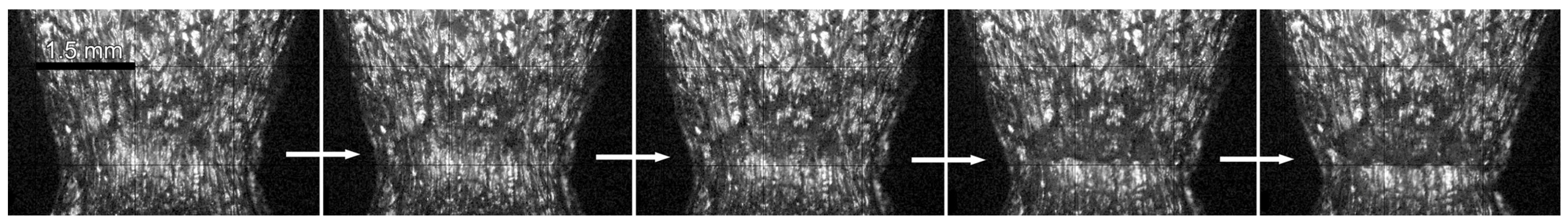 Metals 15 00046 g011