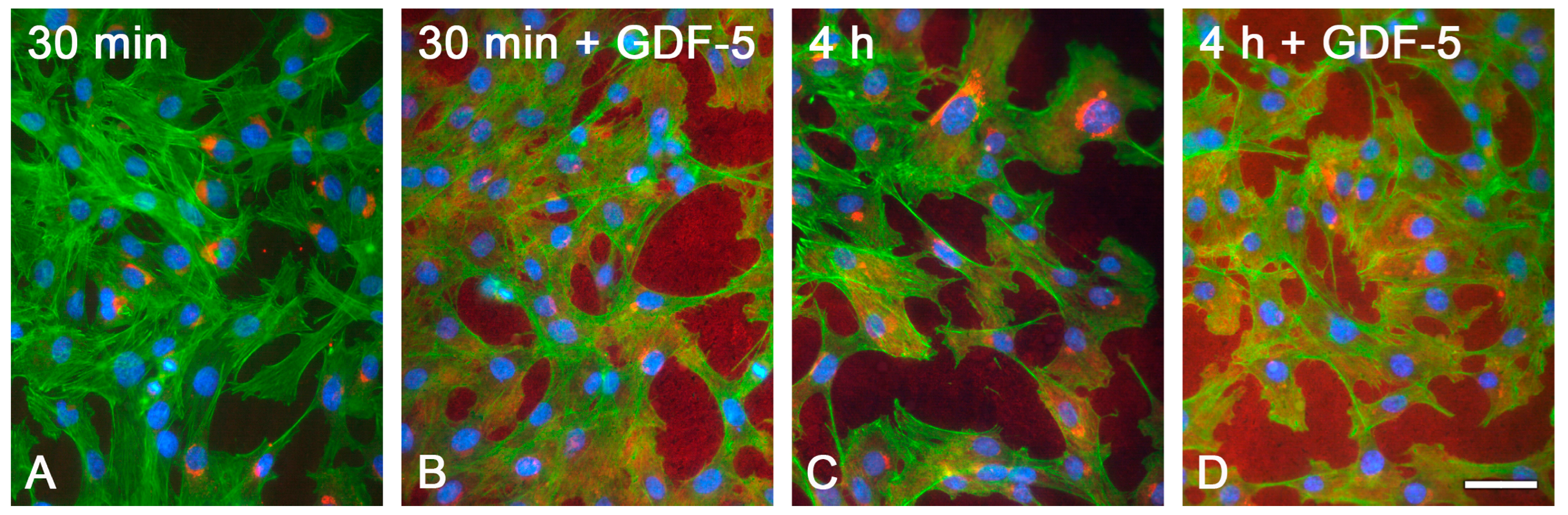 Metals 15 00167 g007