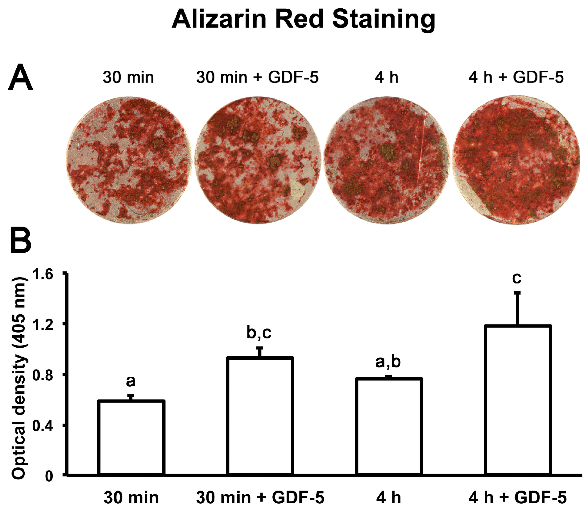 Metals 15 00167 g010
