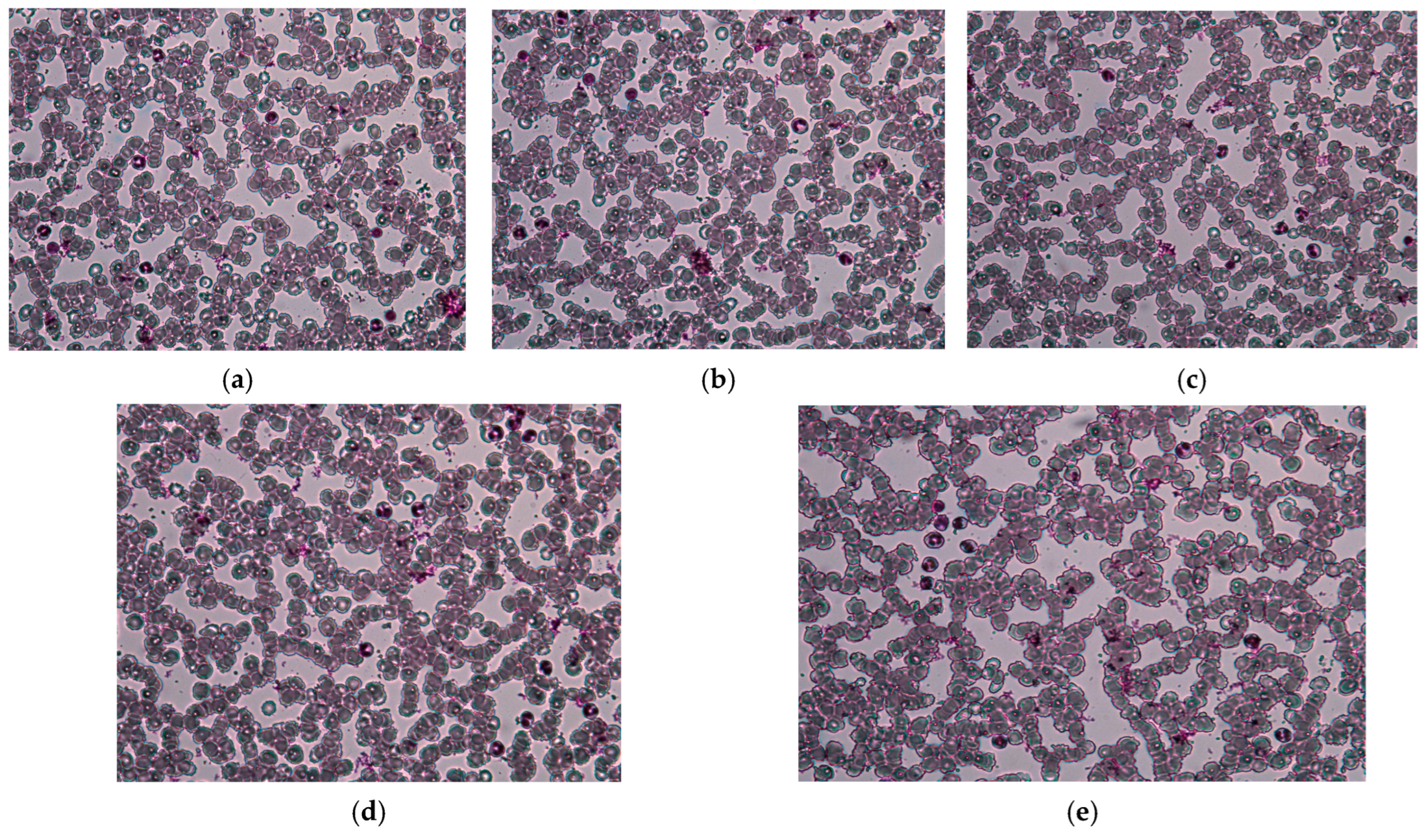 Metals 15 00240 g011