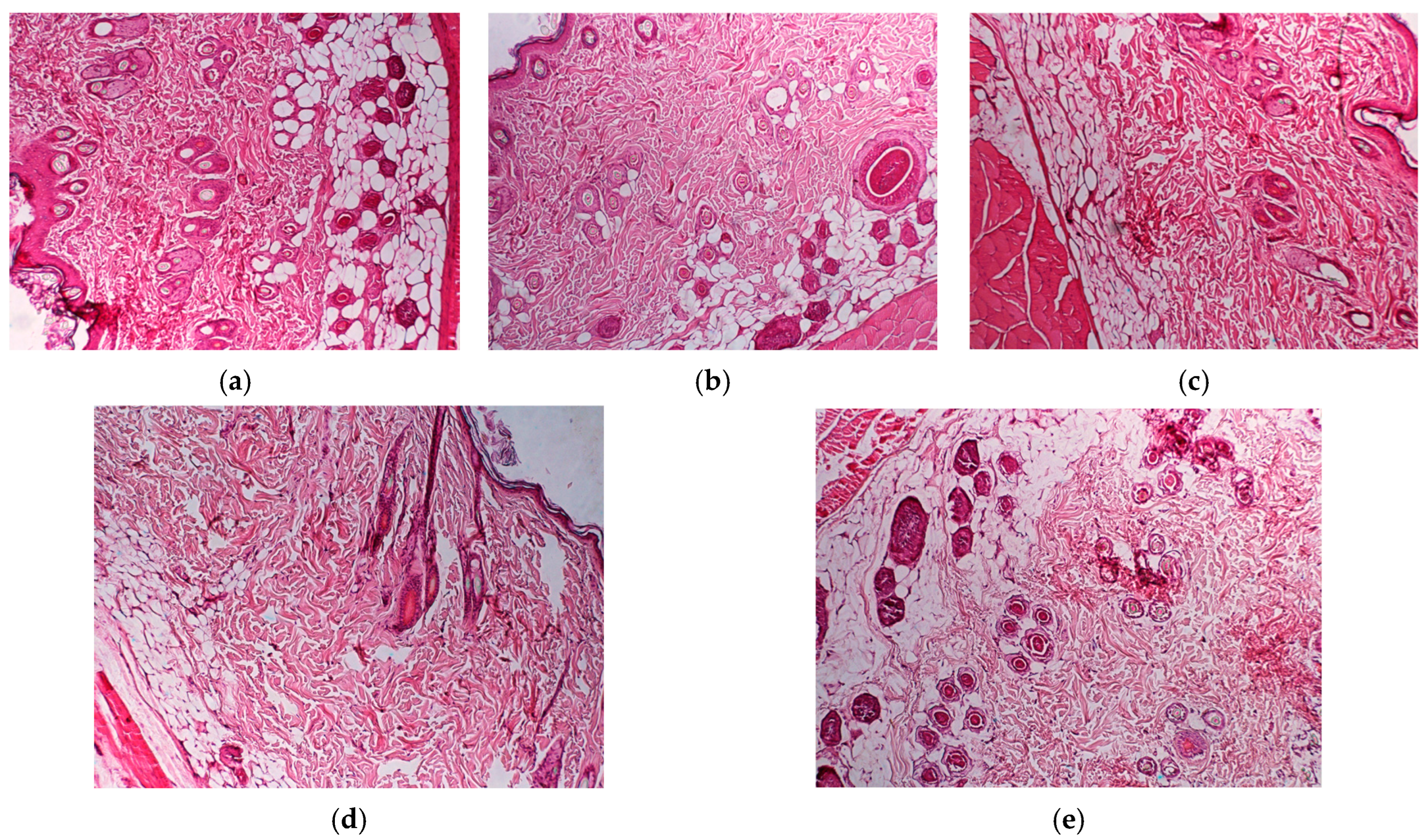 Metals 15 00240 g013