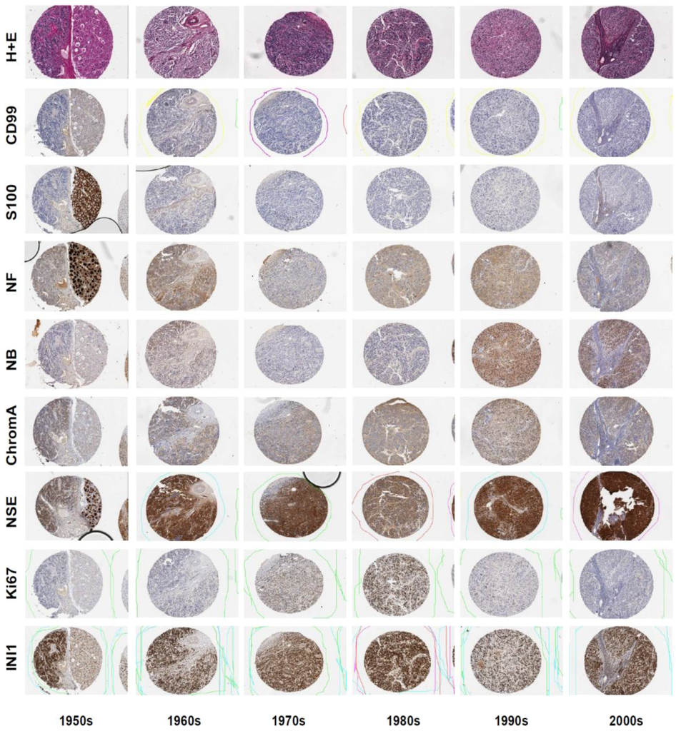 Microarrays 03 00072 g003 1024