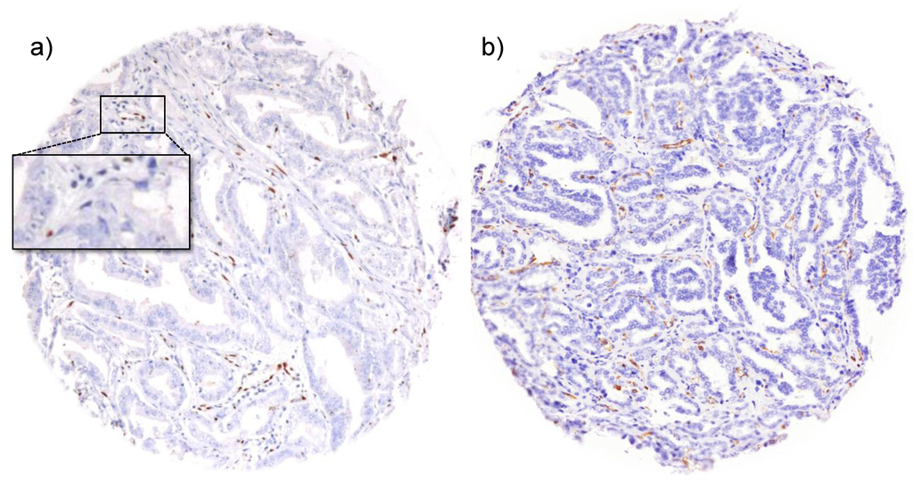 Microarrays 03 00137 g002 1024