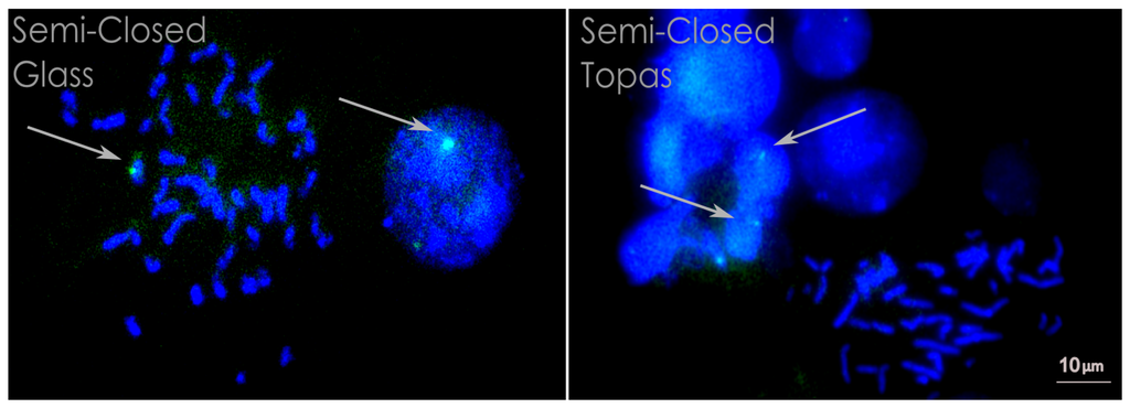 Micromachines 05 00158 g005 1024