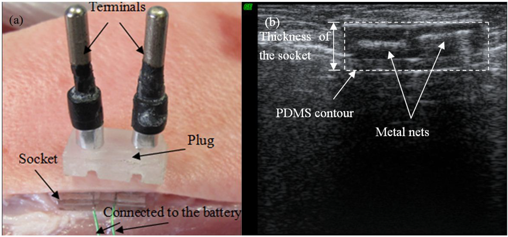 Micromachines 06 00396 g010 1024