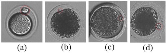 Micromachines 07 00027 g001 550