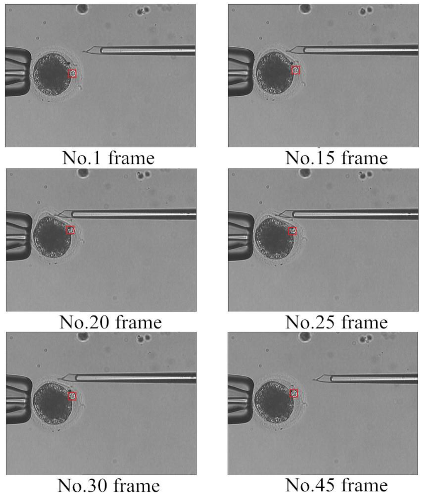 Micromachines 07 00027 g010
