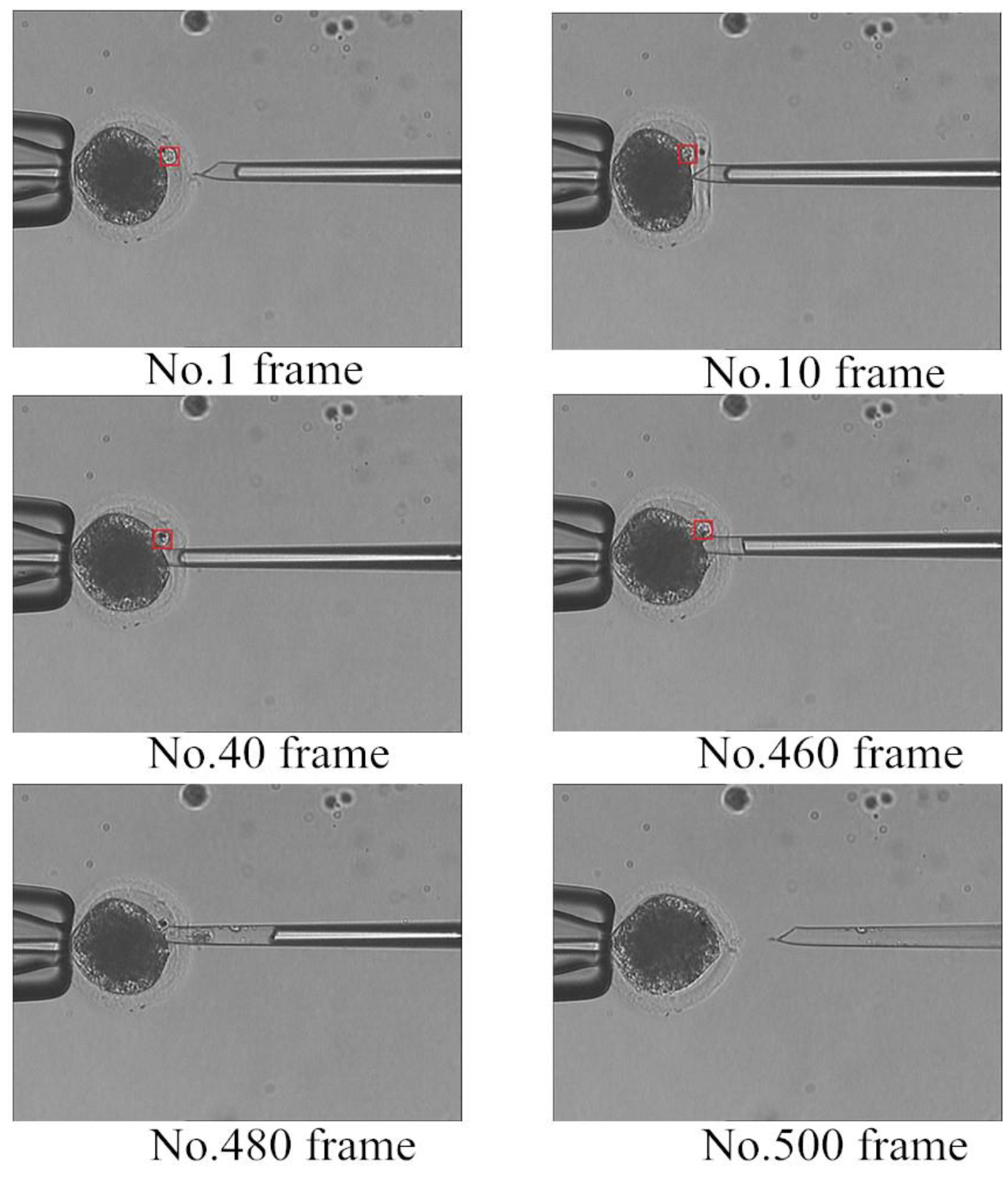 Micromachines 07 00027 g011