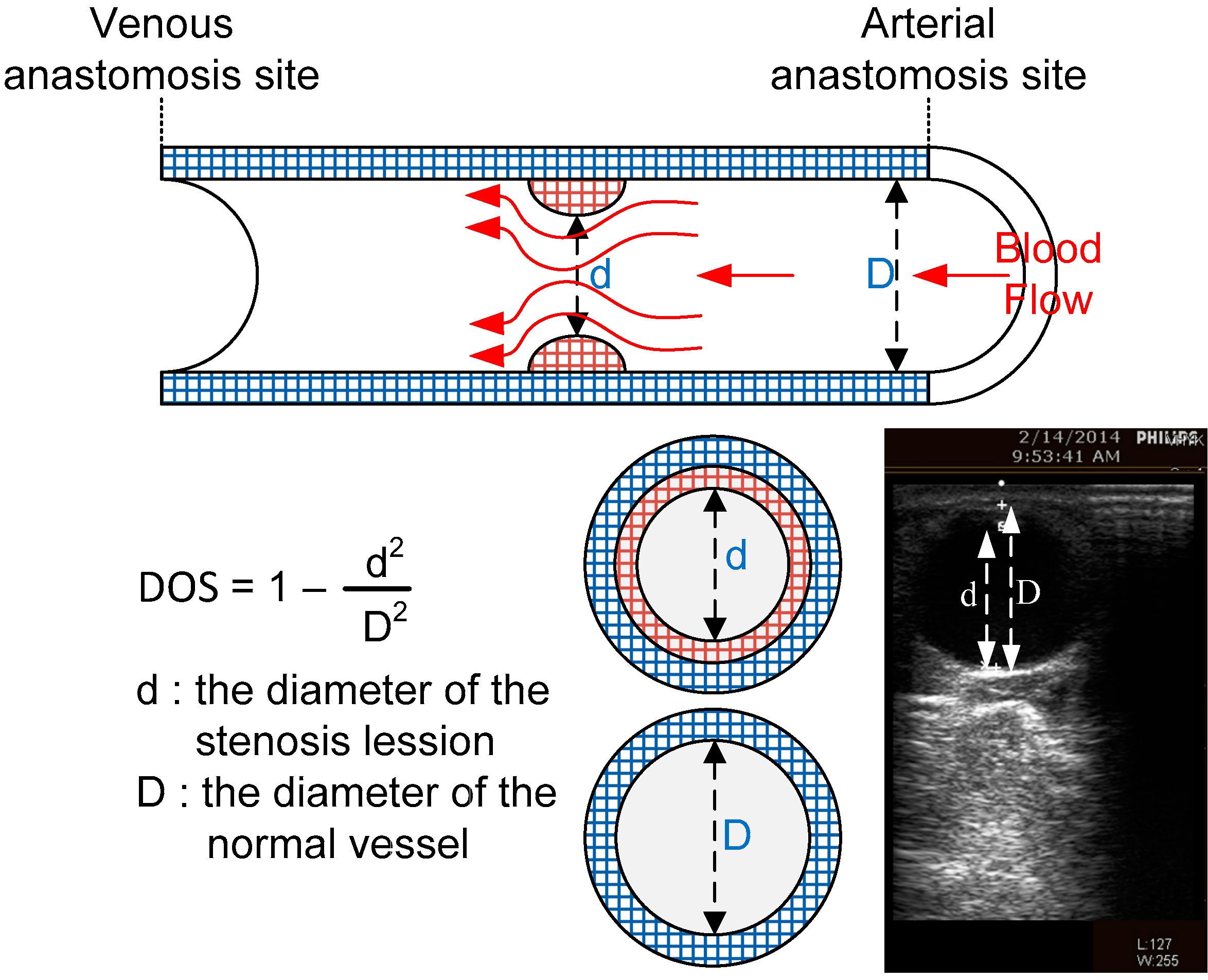 Micromachines 07 00147 g003
