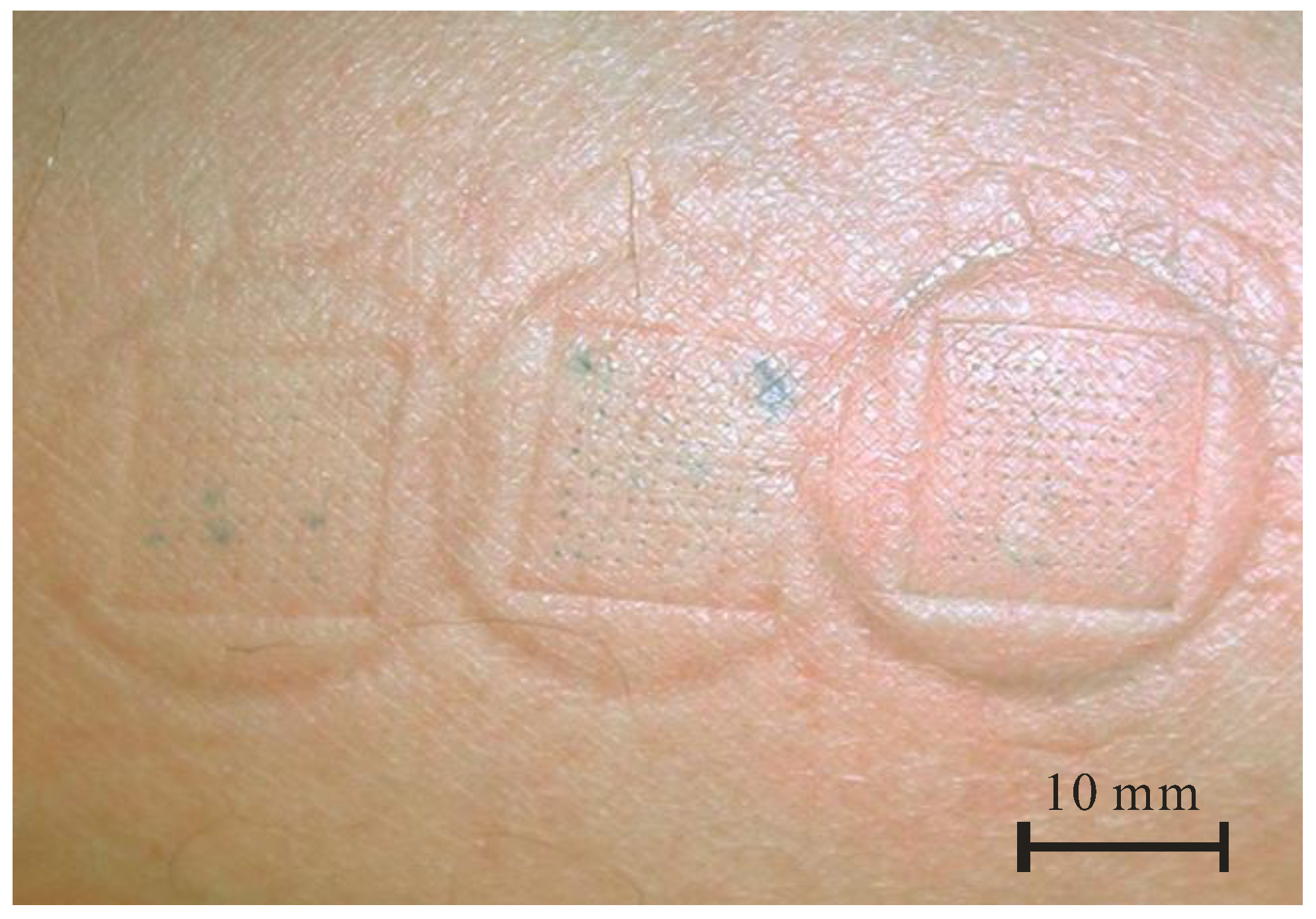 Micromachines 09 00040 g003