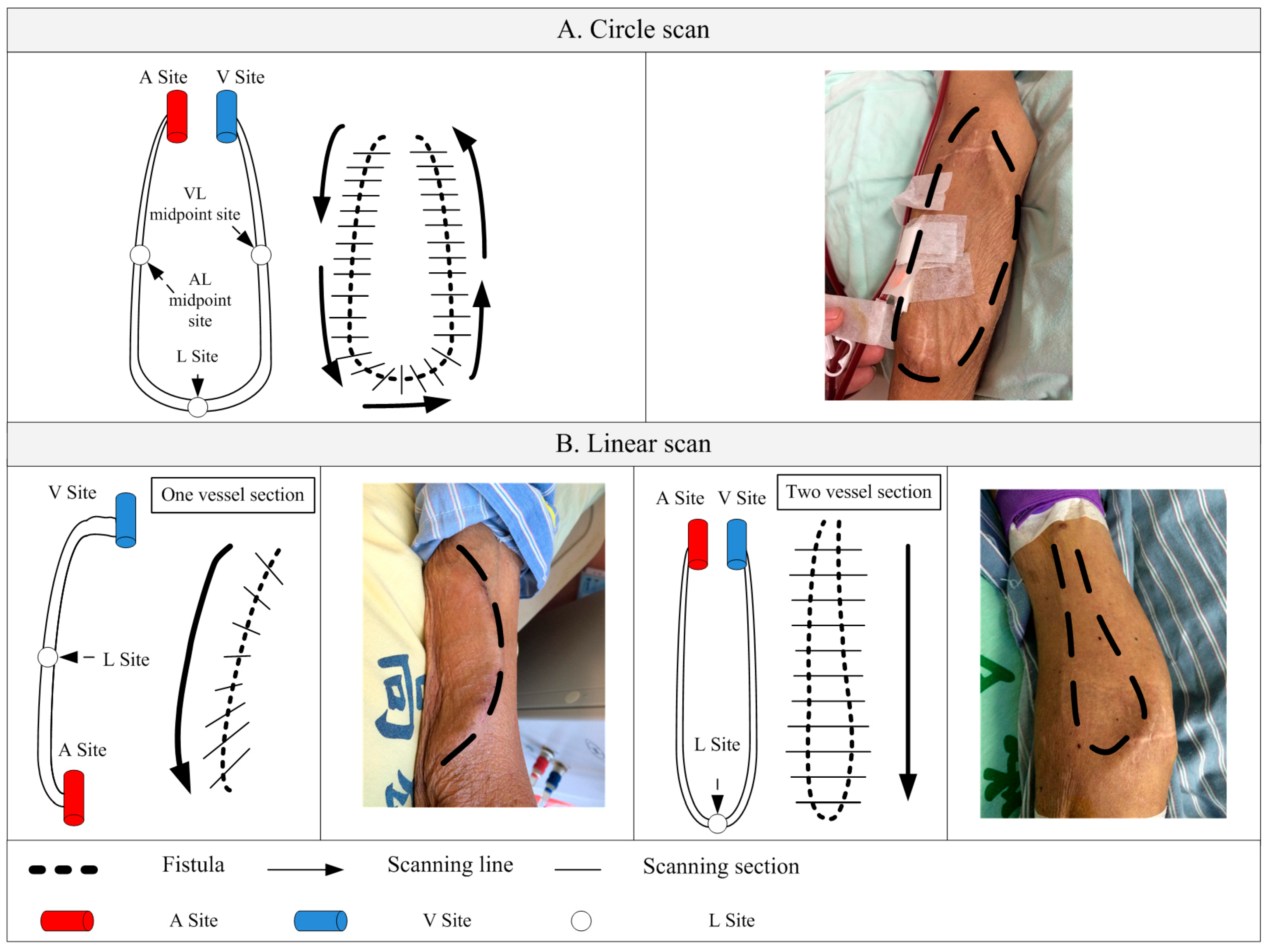Micromachines 09 00051 g004