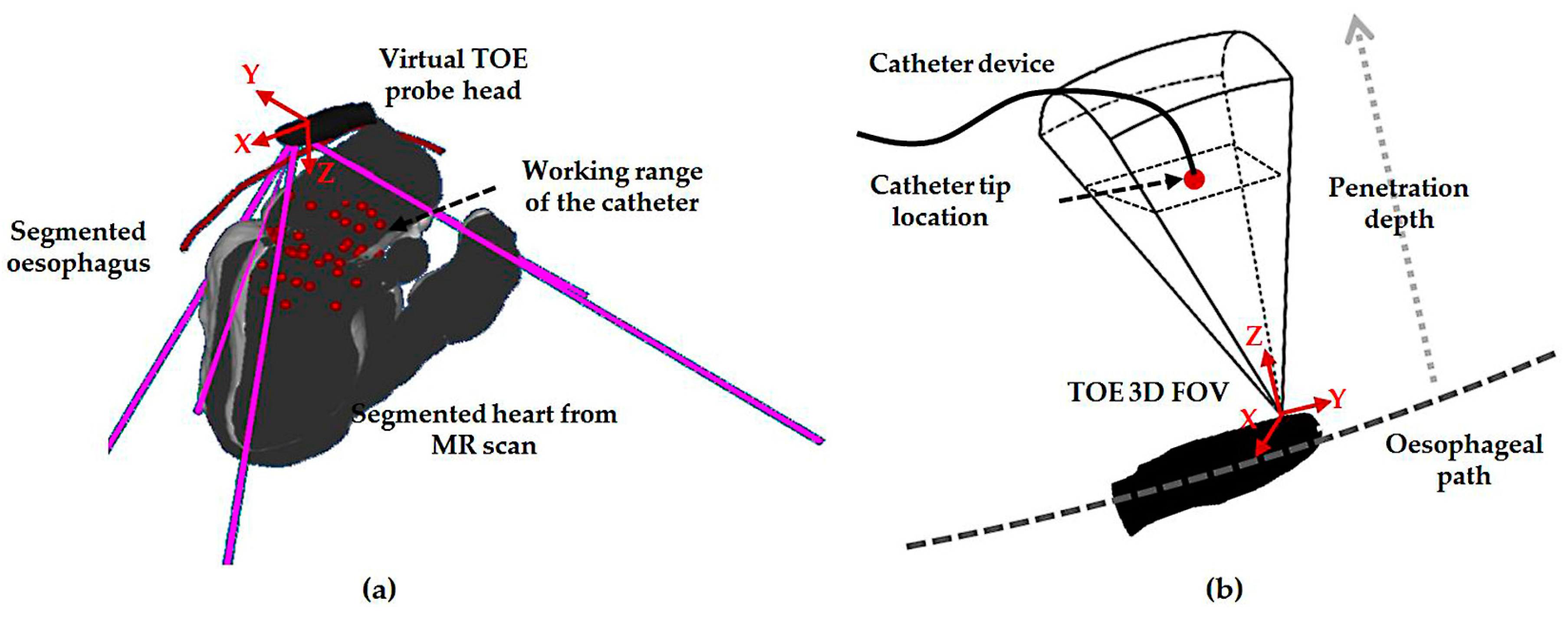 Micromachines 09 00065 g002