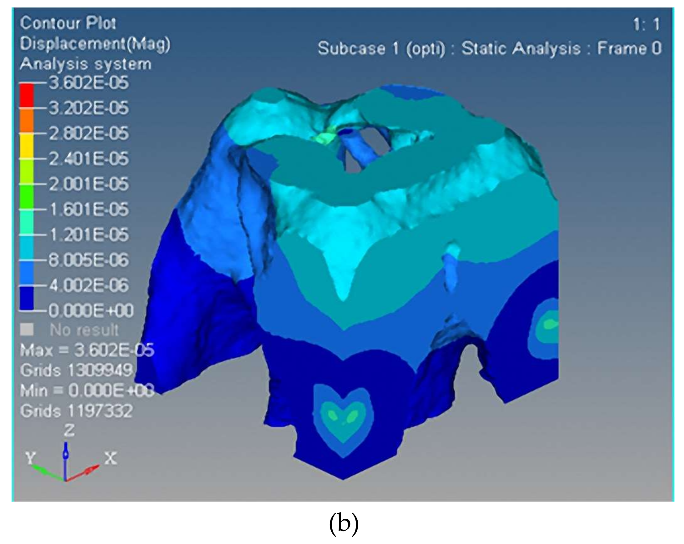 Micromachines 09 00184 g007b