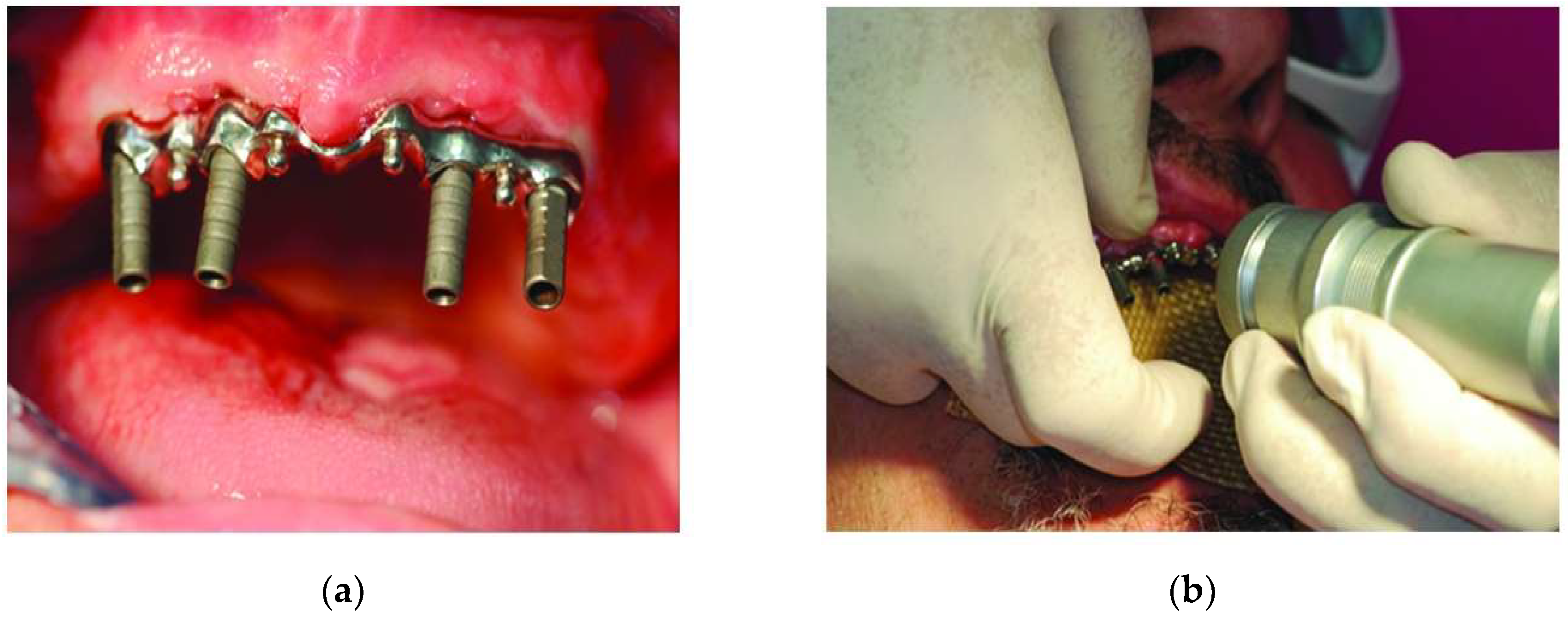 Micromachines 09 00209 g003 Micromachines 09 00209 g003