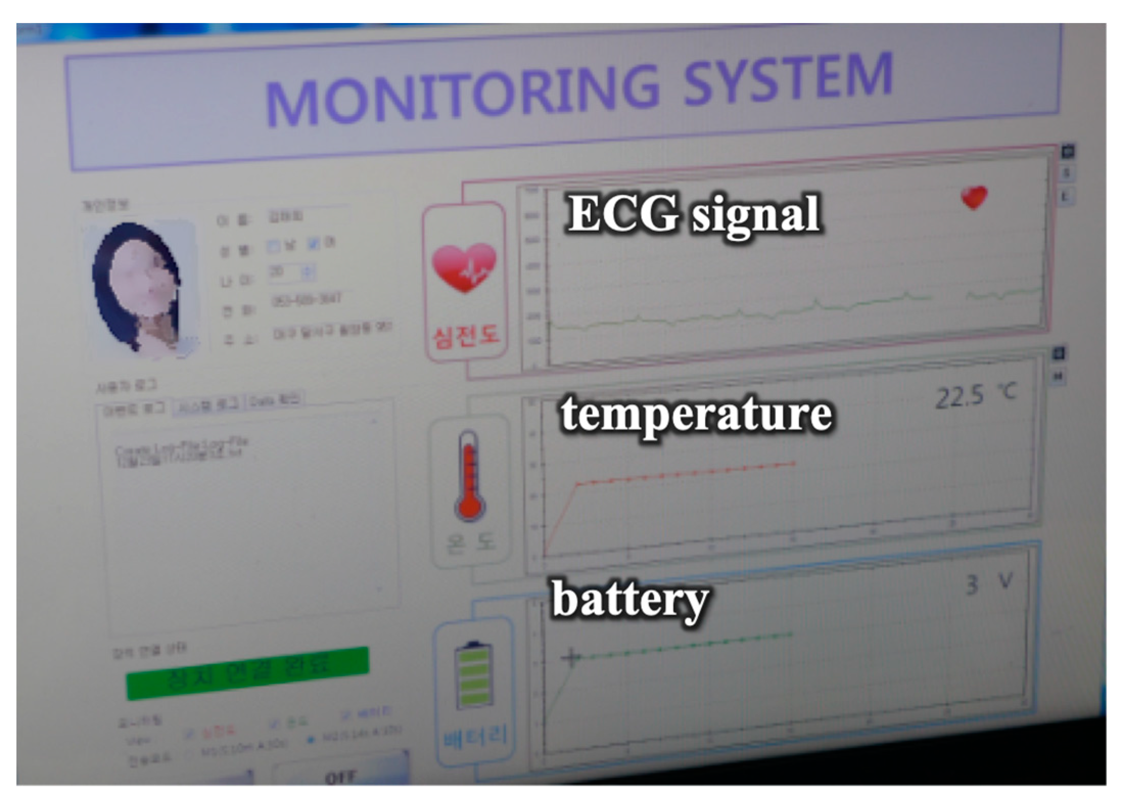 Micromachines 10 00038 g005