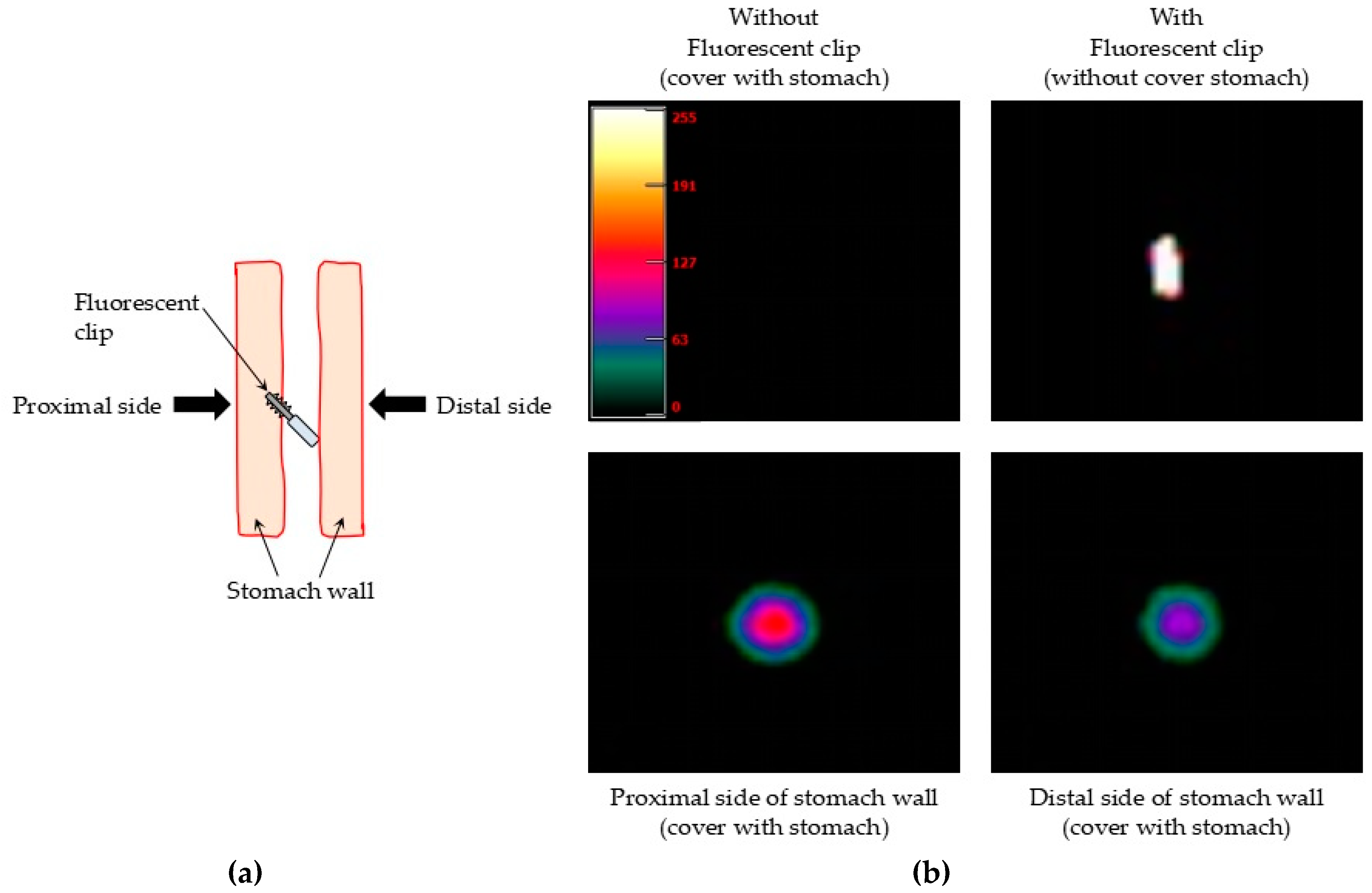 Micromachines 10 00081 g006