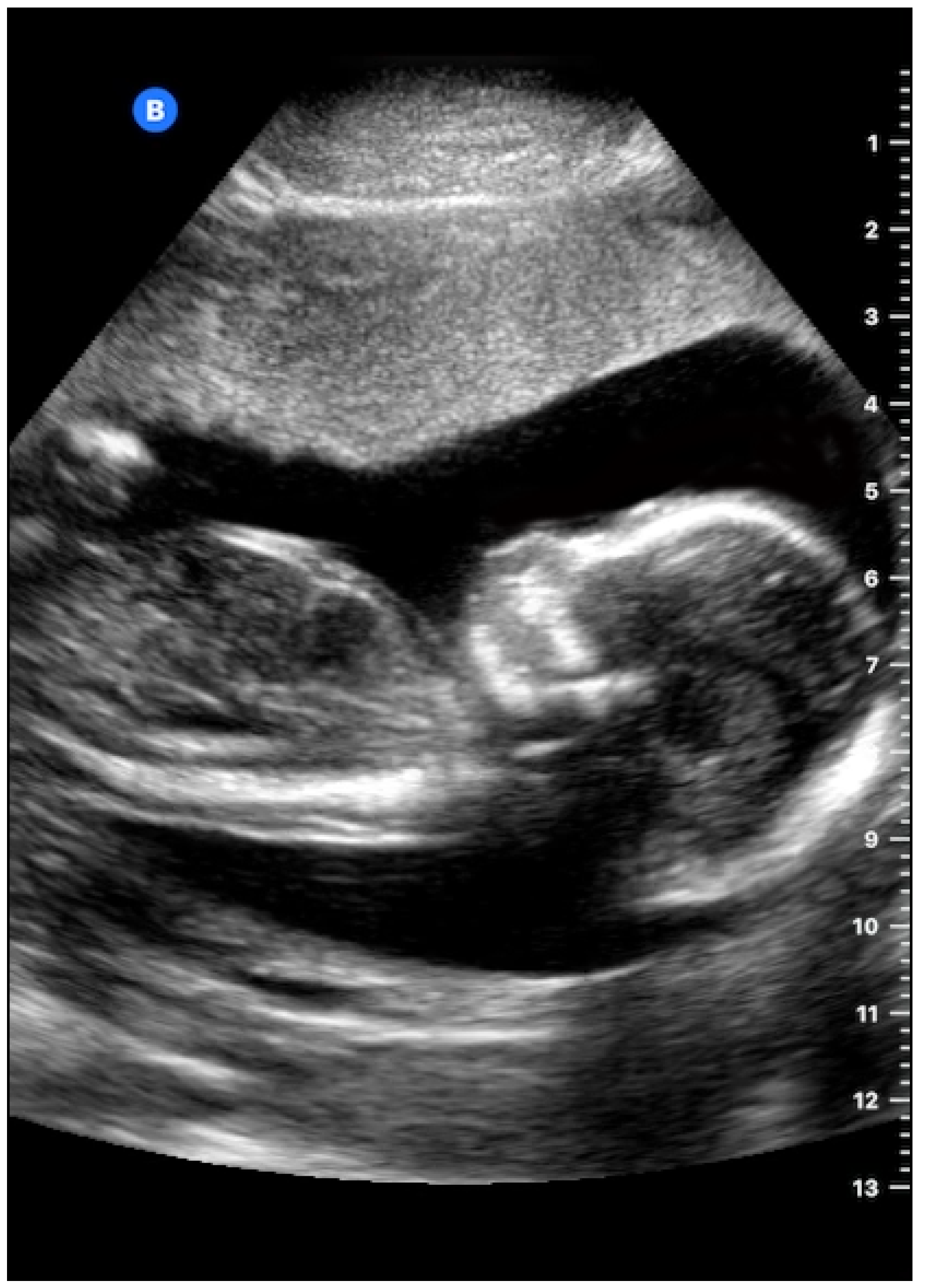 Micromachines 10 00152 g015