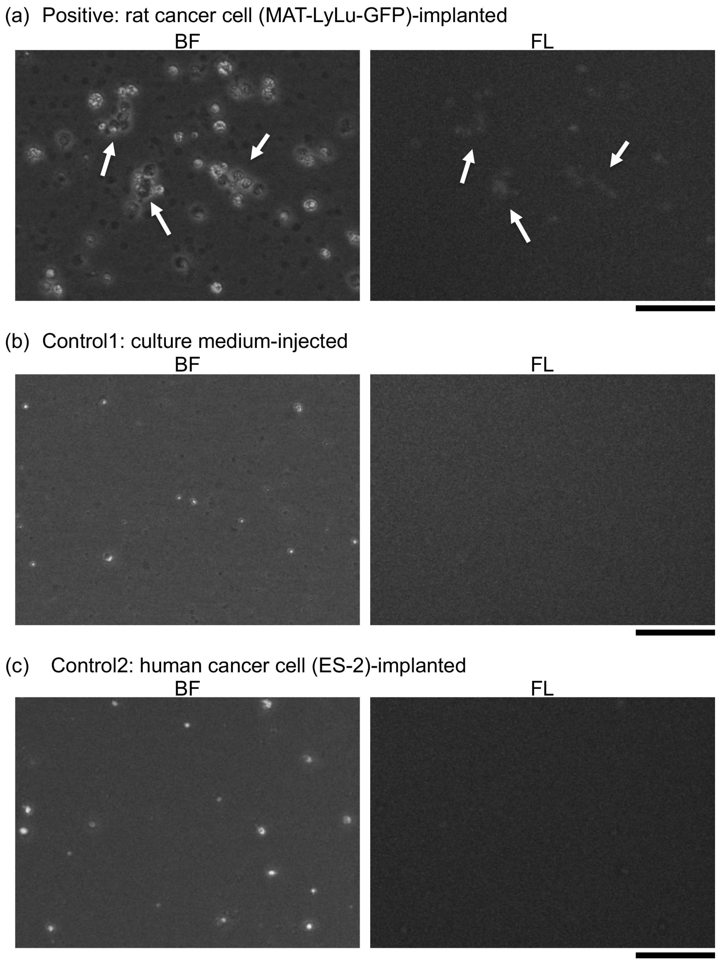 Micromachines 10 00154 g015