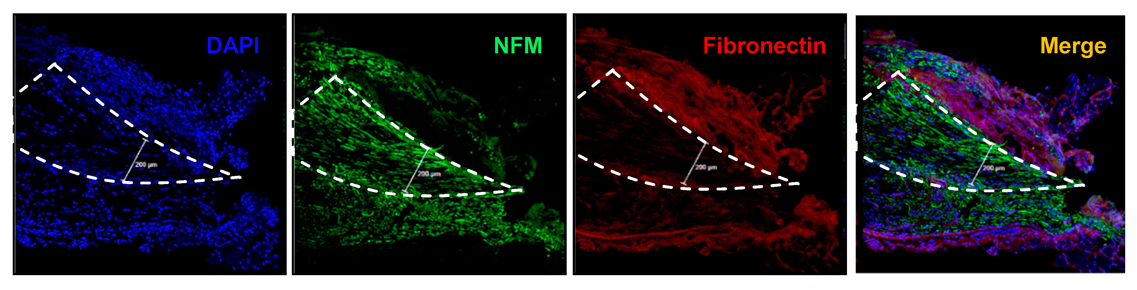 Micromachines 10 00184 g006