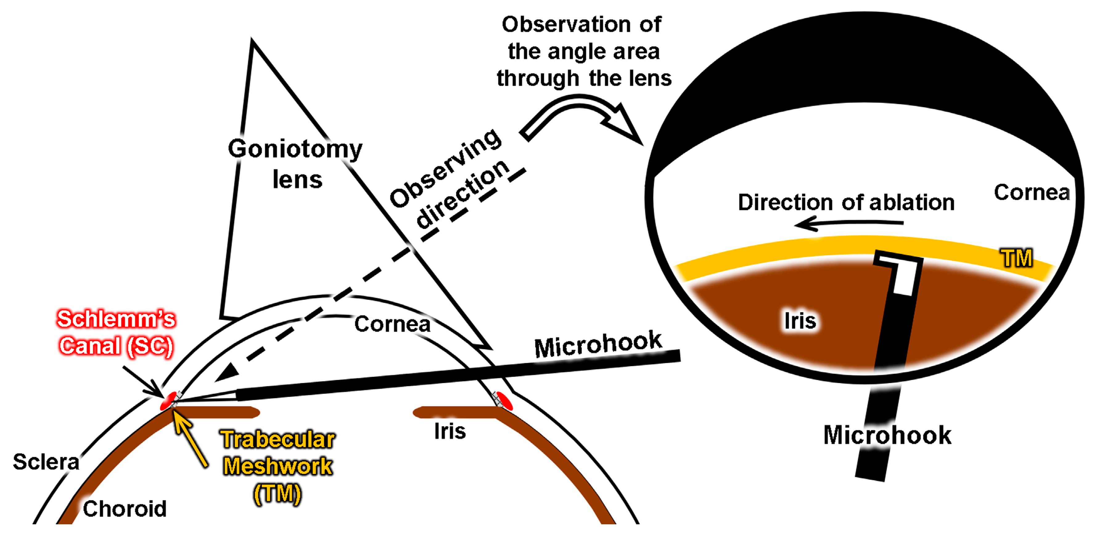 Micromachines 10 00297 g002