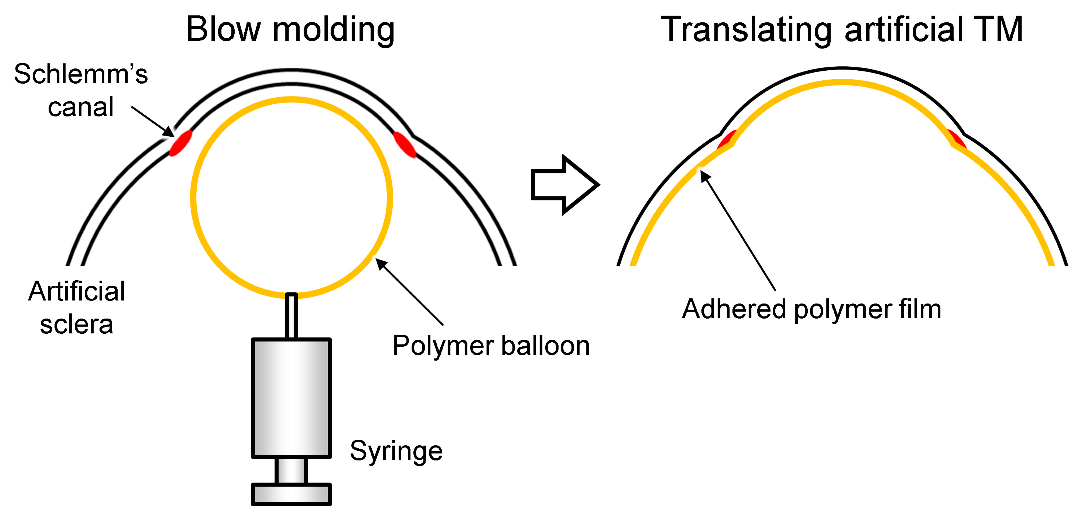 Micromachines 10 00297 g004