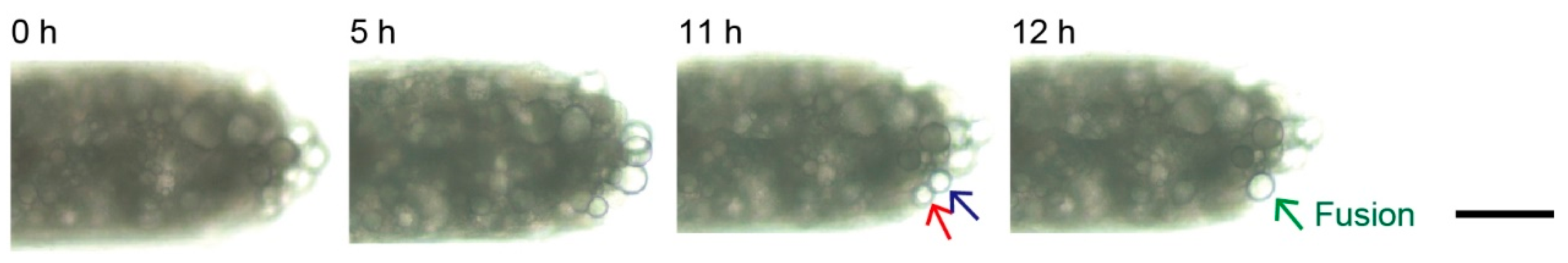 Micromachines 10 00358 g009