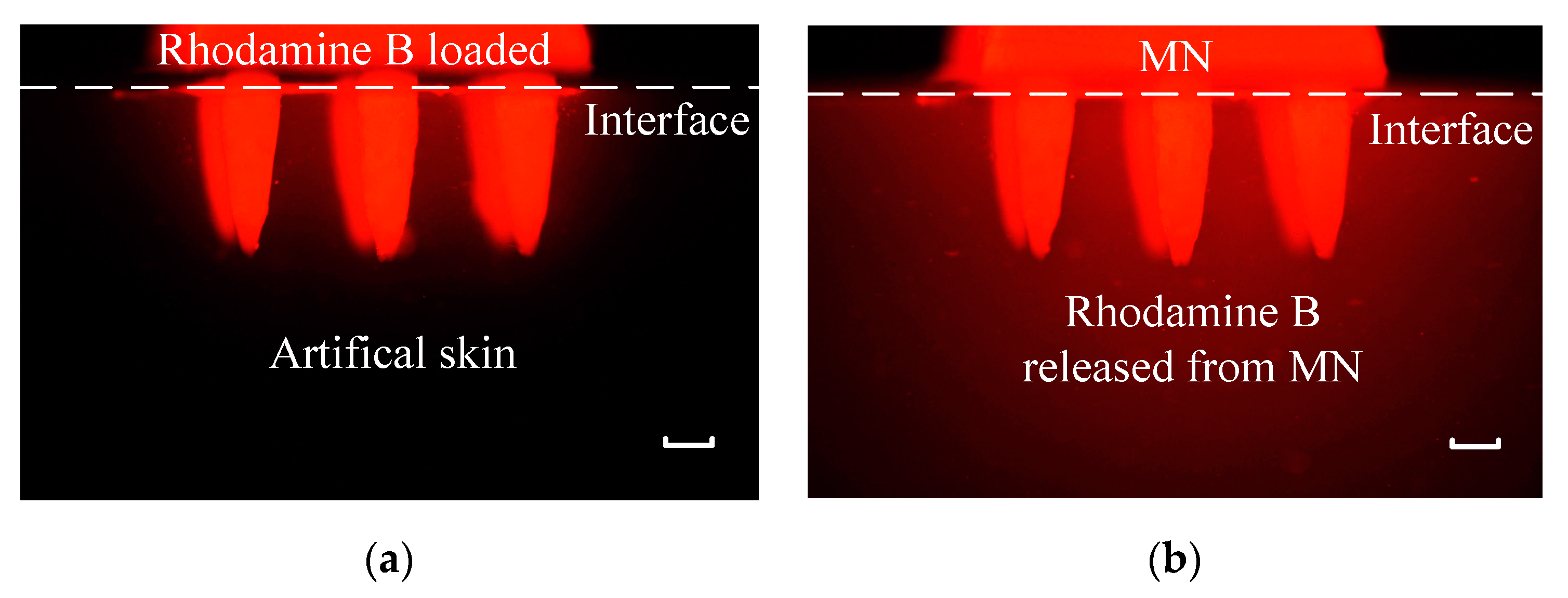 Micromachines 11 00017 g009