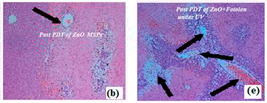 Micromachines 11 00262 g001