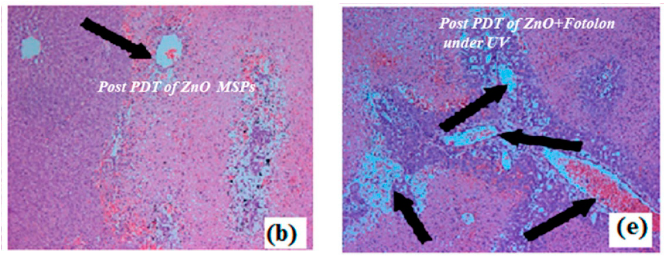 Micromachines 11 00262 g001 Micromachines 11 00262 g001