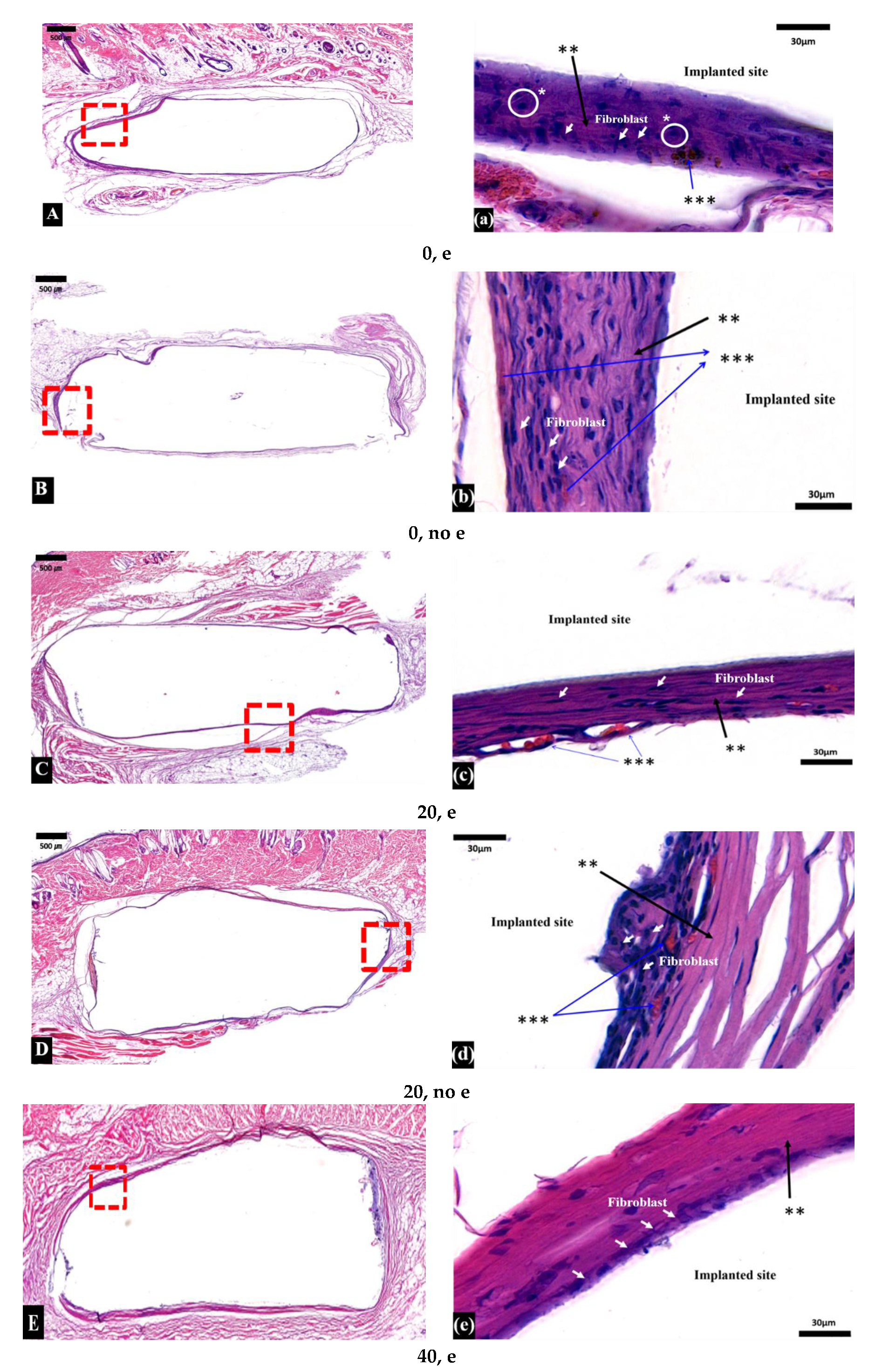 Micromachines 11 00273 g004a