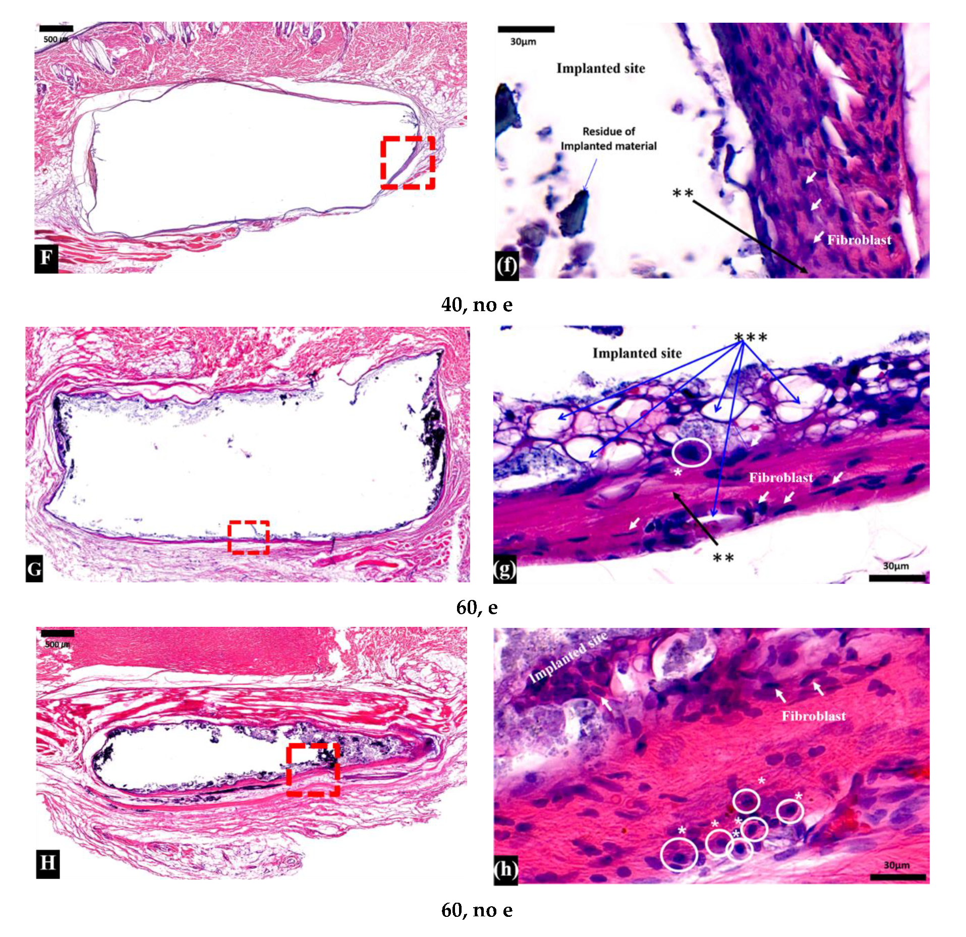 Micromachines 11 00273 g004b