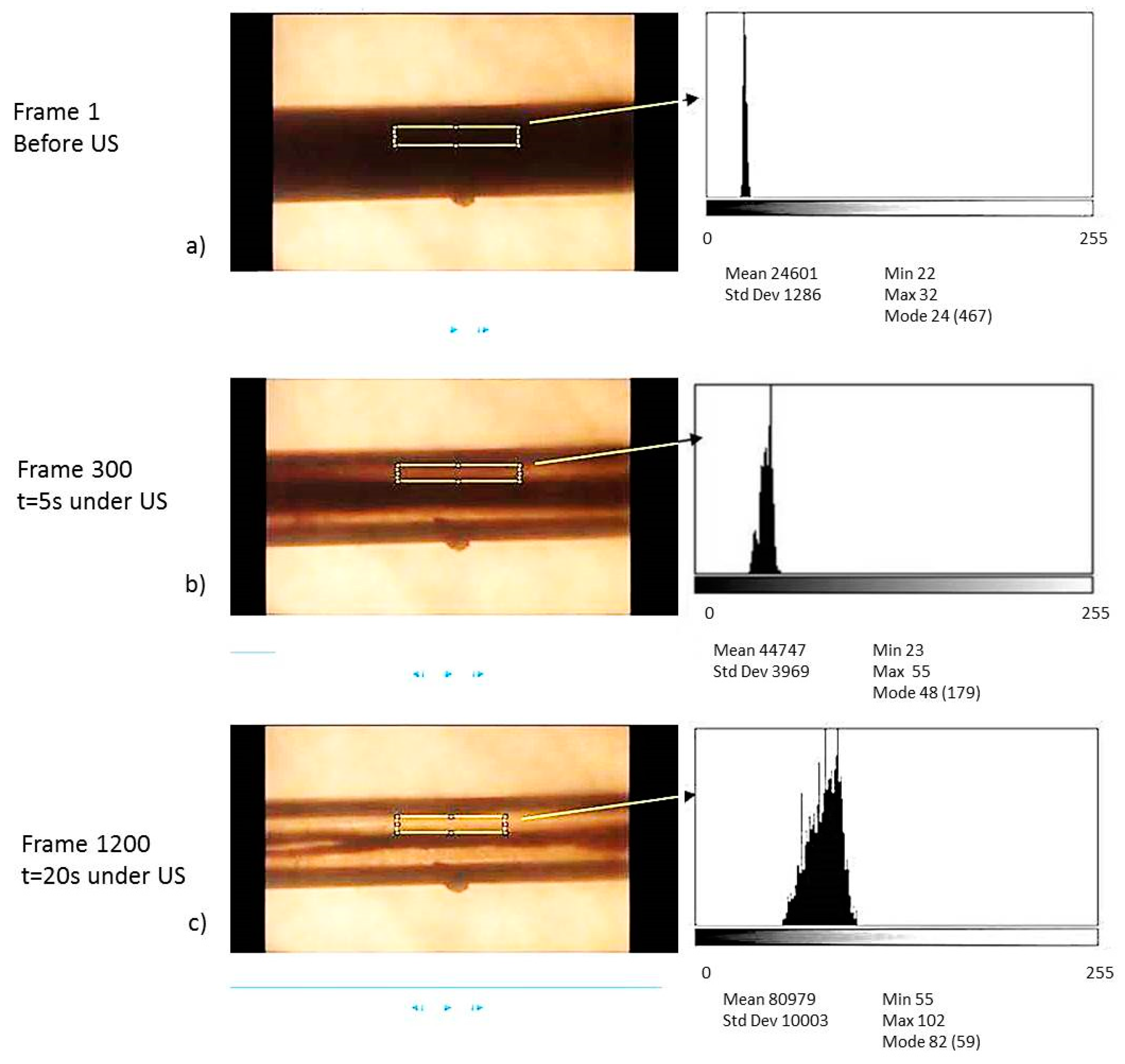Micromachines 11 00751 g003