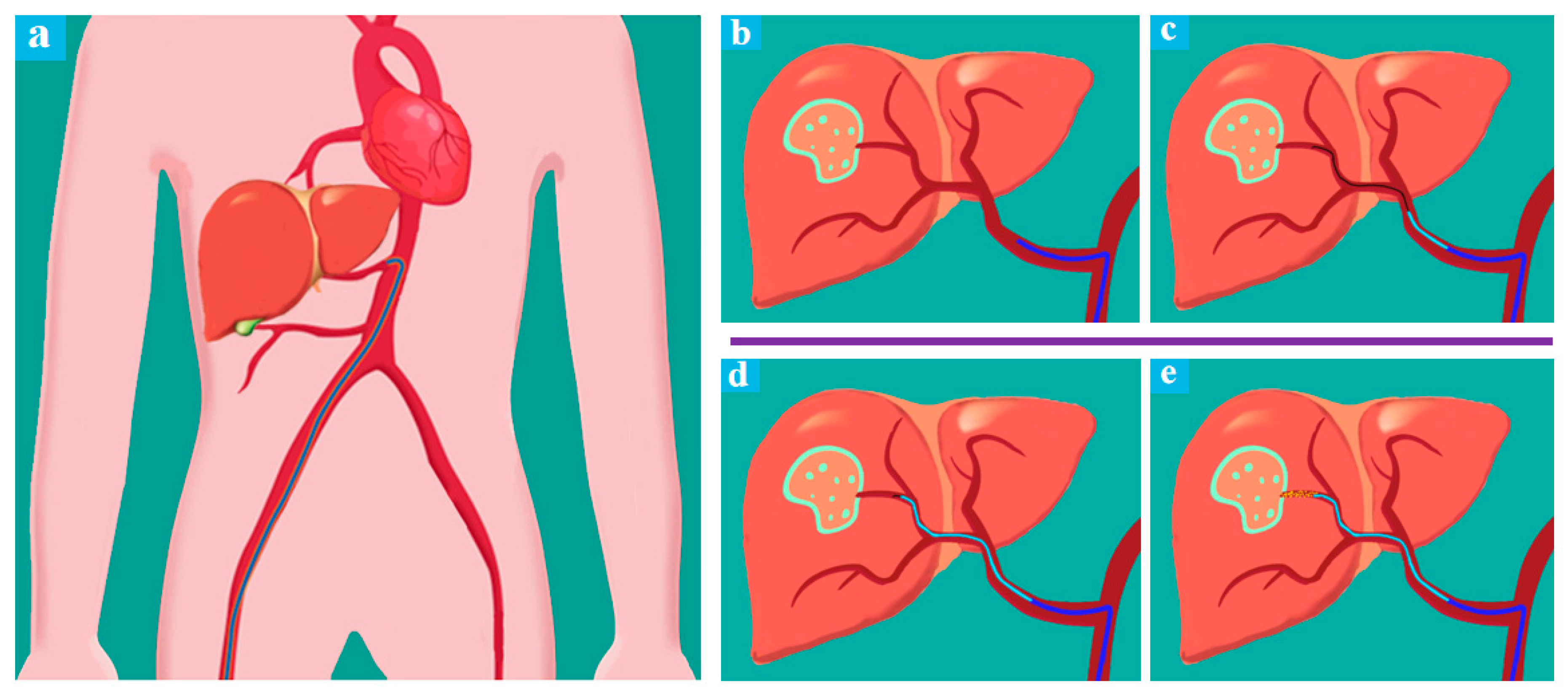 Micromachines 11 00805 g002