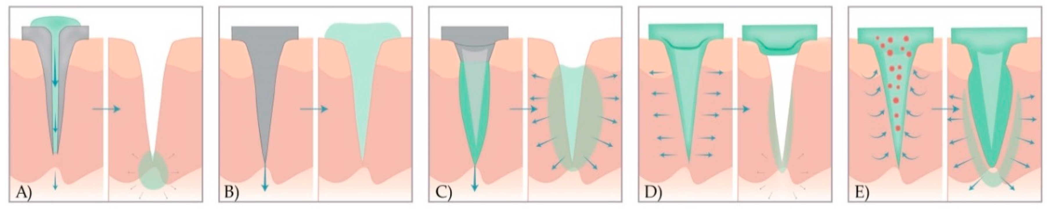 Micromachines 11 00961 g002 Micromachines 11 00961 g002