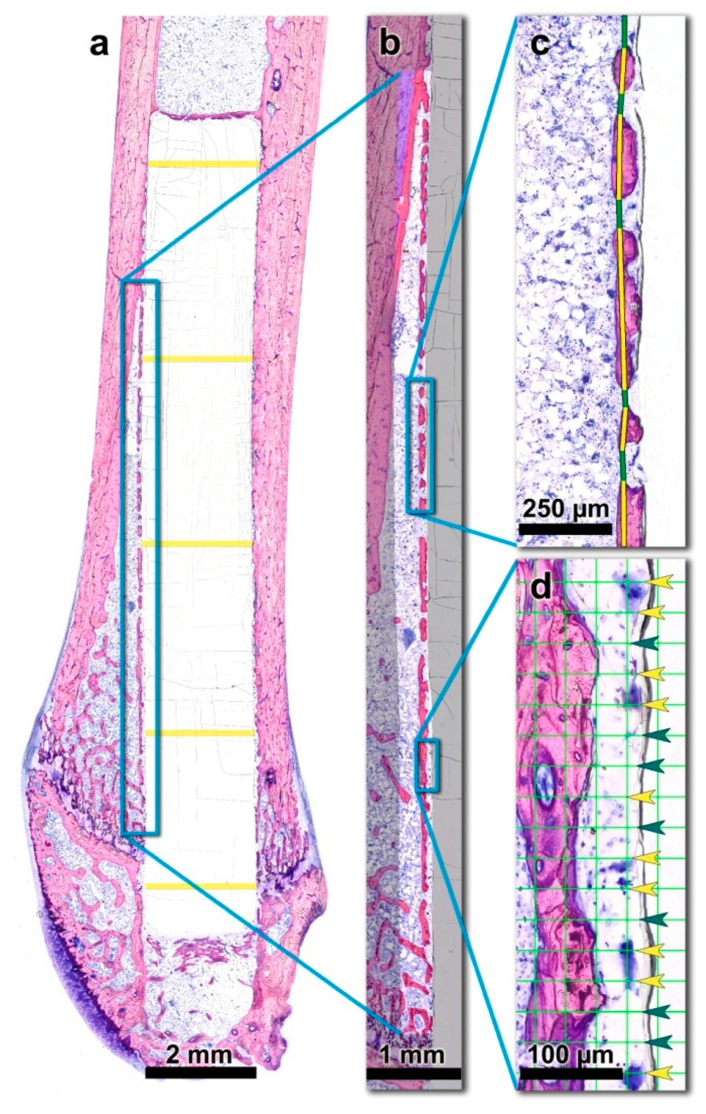 Micromachines 11 01098 g002