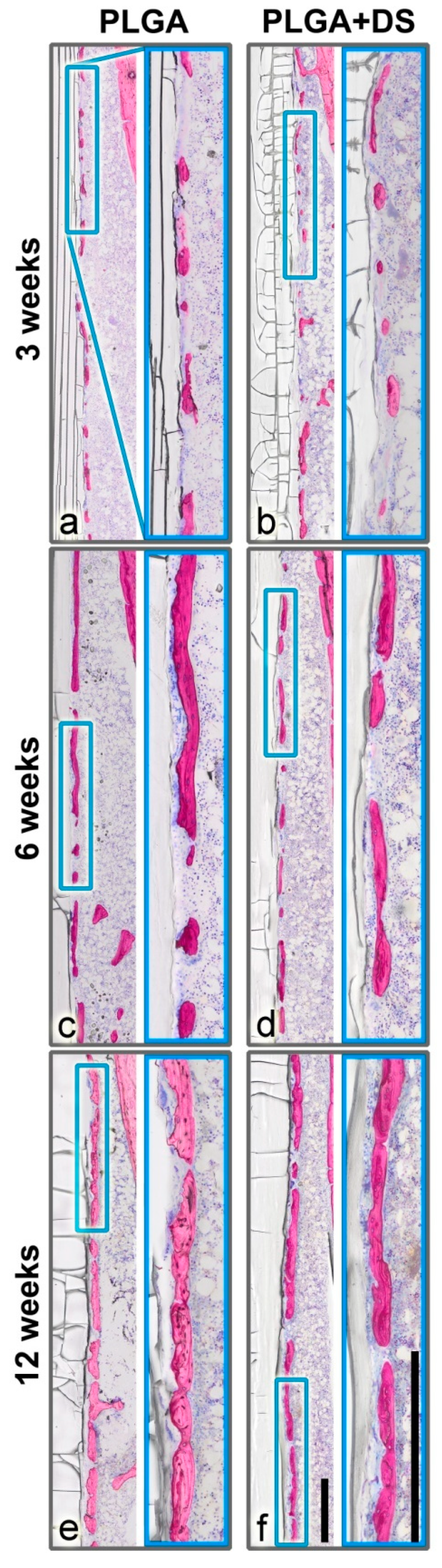 Micromachines 11 01098 g003
